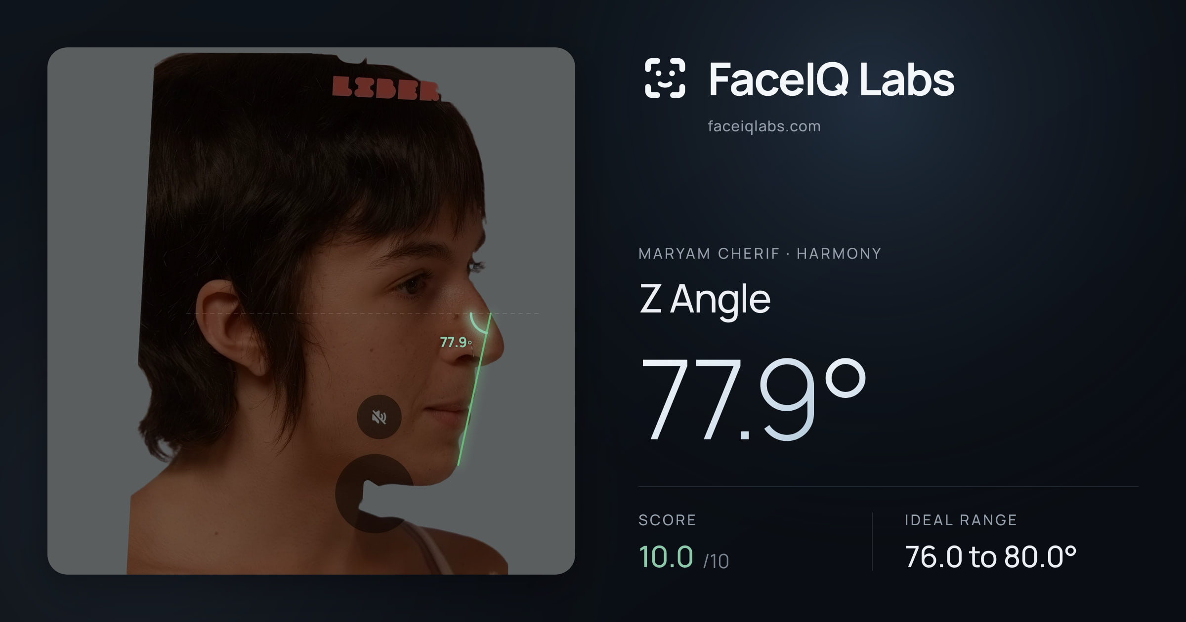 Maryam Cherif Z Angle: 77.9°, drawn on the photo