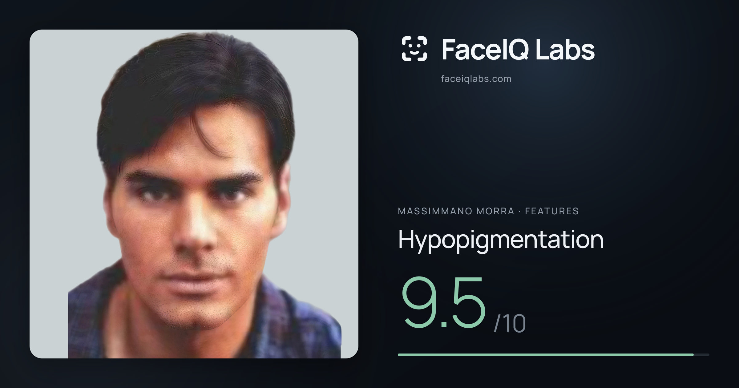 Massimmano Morra Hypopigmentation: 9.5/10, drawn on the photo