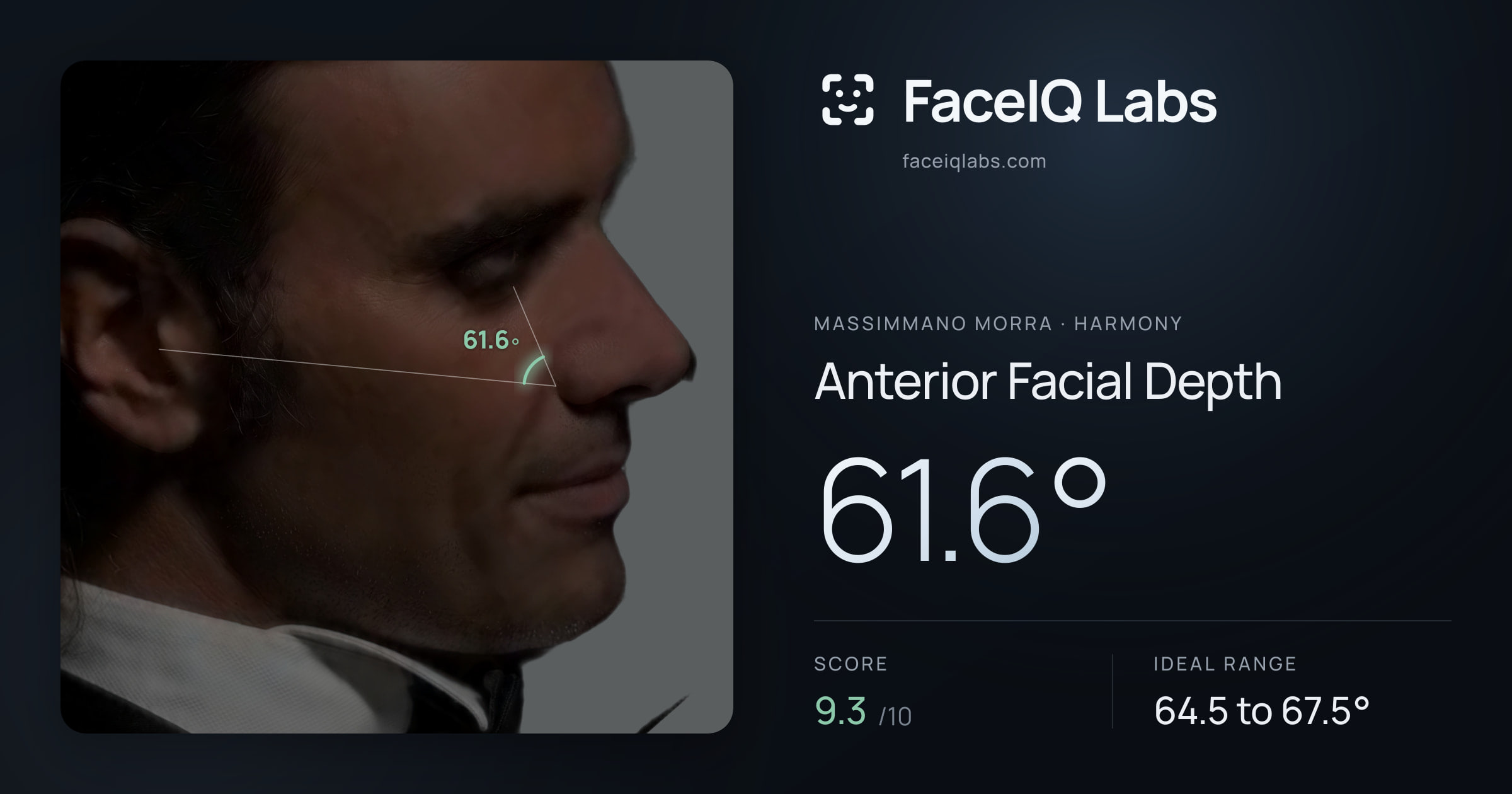Massimmano Morra Anterior Facial Depth: 61.6°, drawn on the photo