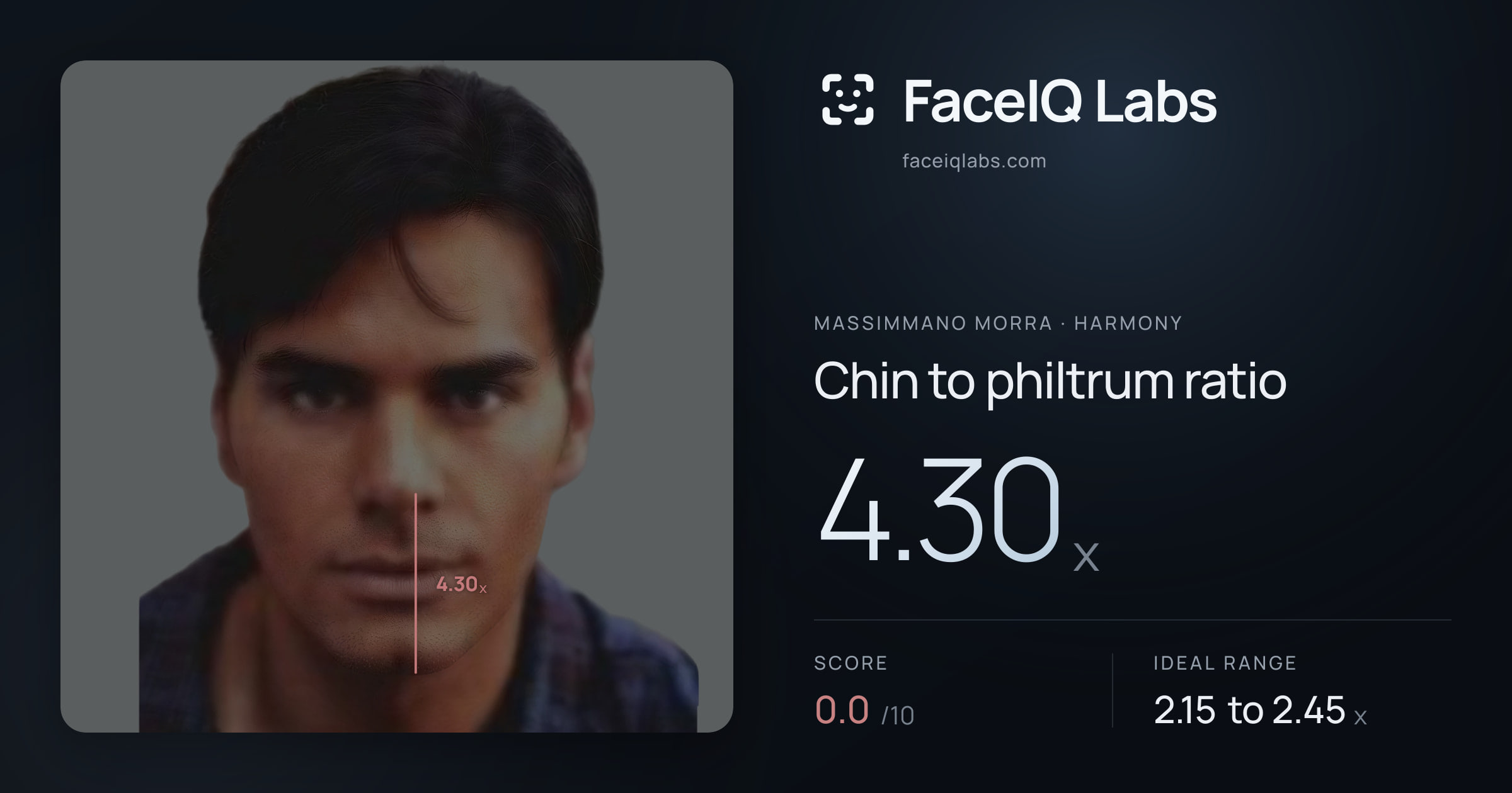 Massimmano Morra Chin to philtrum ratio: 4.30x, drawn on the photo