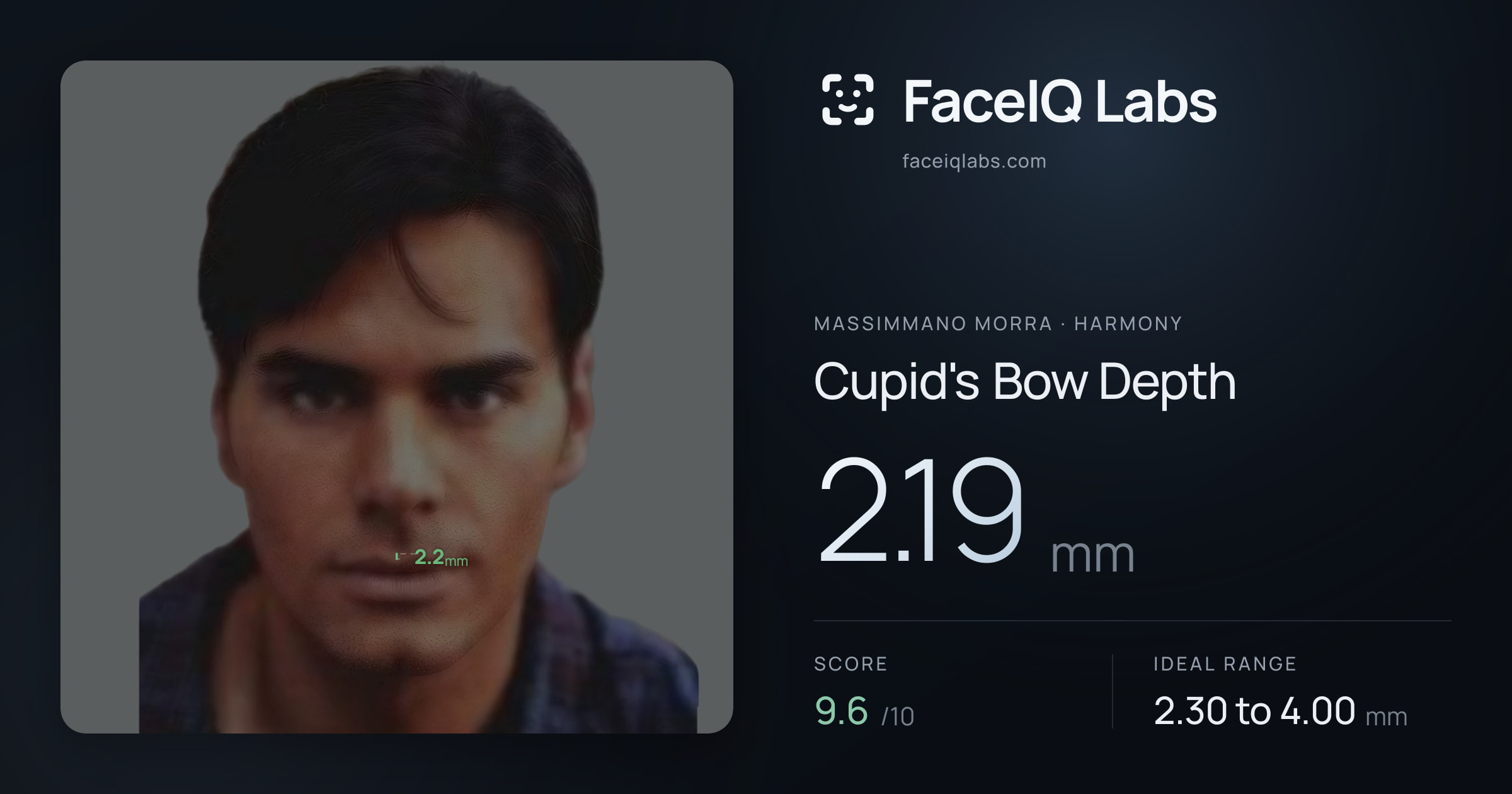 Massimmano Morra Cupid's Bow Depth: 2.19mm, drawn on the photo
