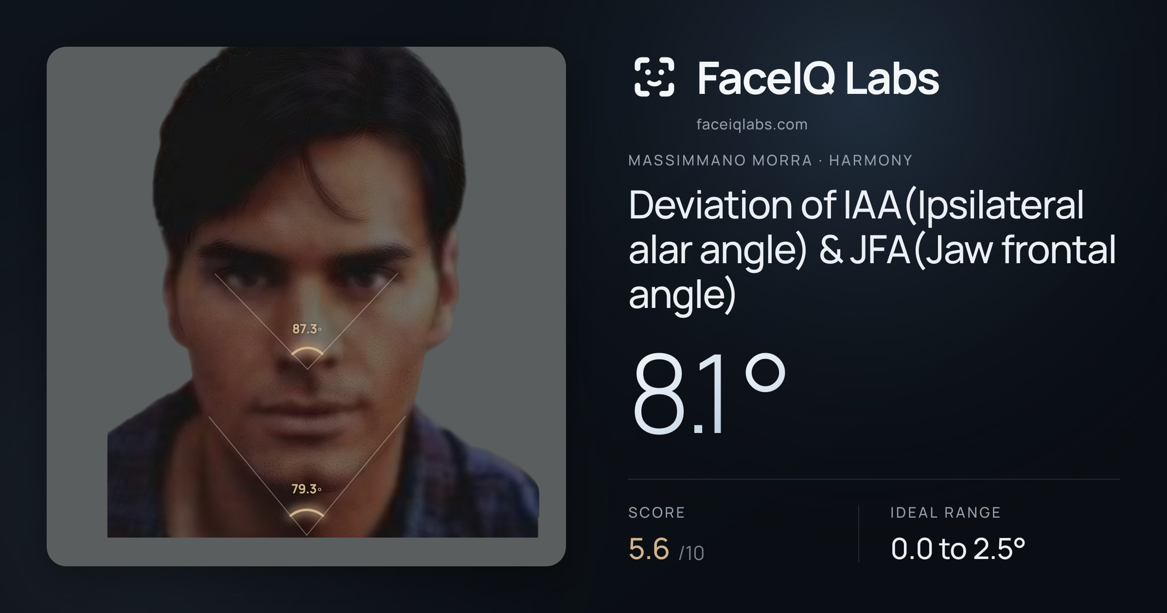 Massimmano Morra Deviation of IAA(Ipsilateral alar angle) & JFA(Jaw frontal angle): 8.1°, drawn on the photo