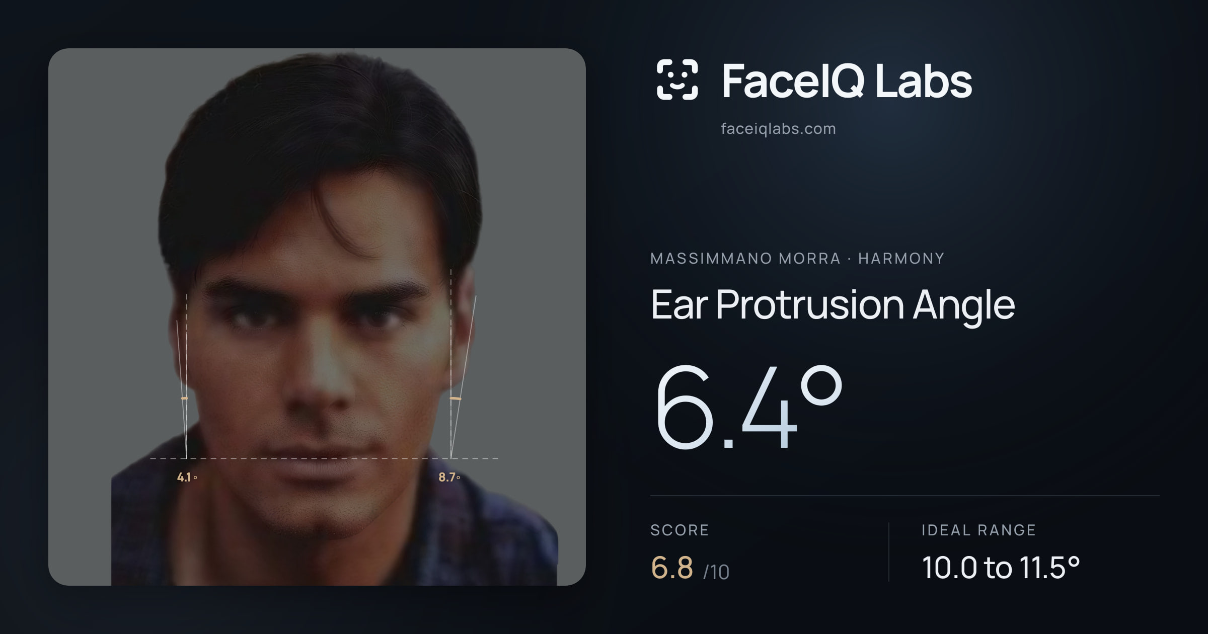 Massimmano Morra Ear Protrusion Angle: 6.4°, drawn on the photo
