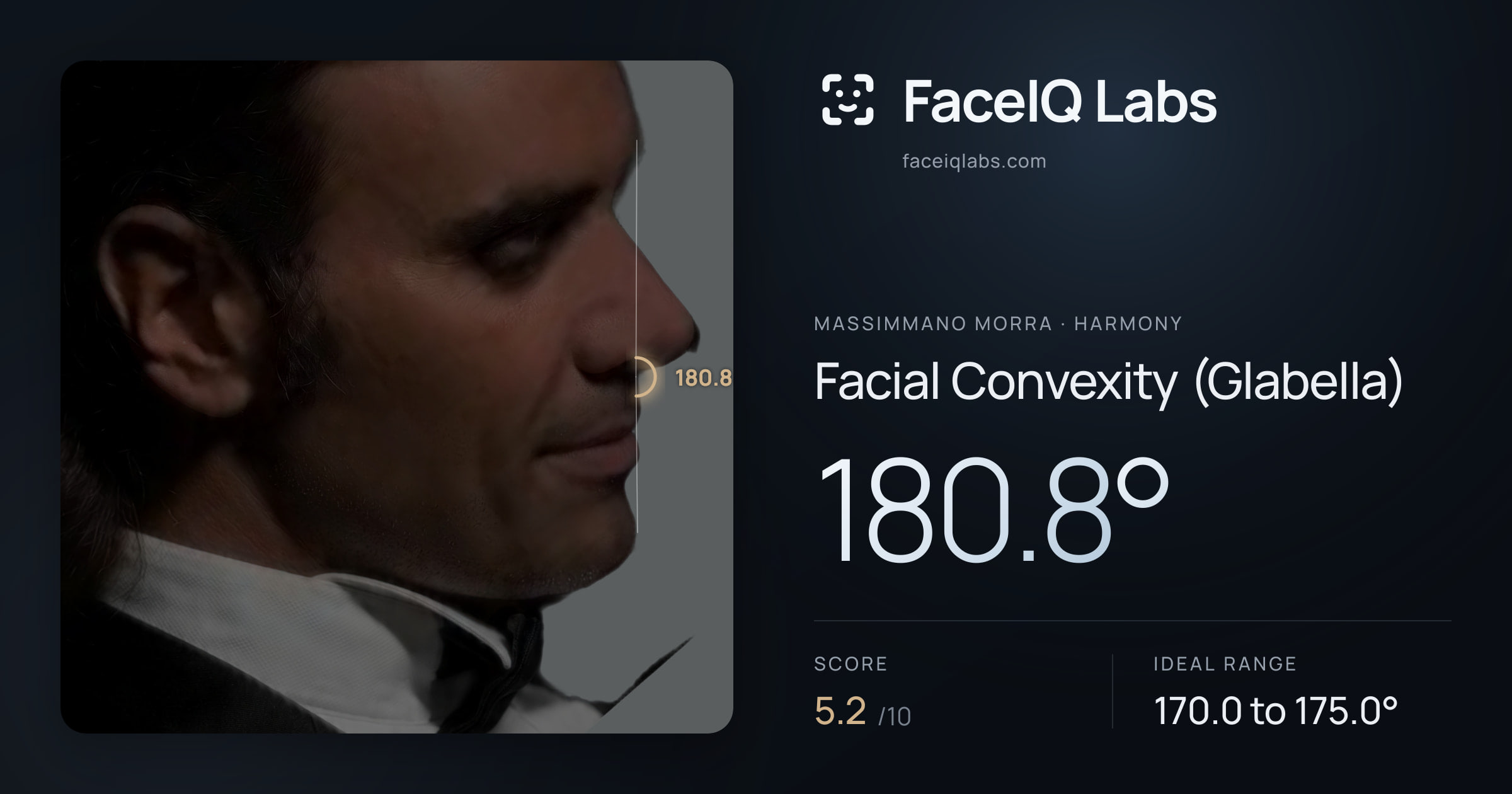 Massimmano Morra Facial Convexity (Glabella): 180.8°, drawn on the photo