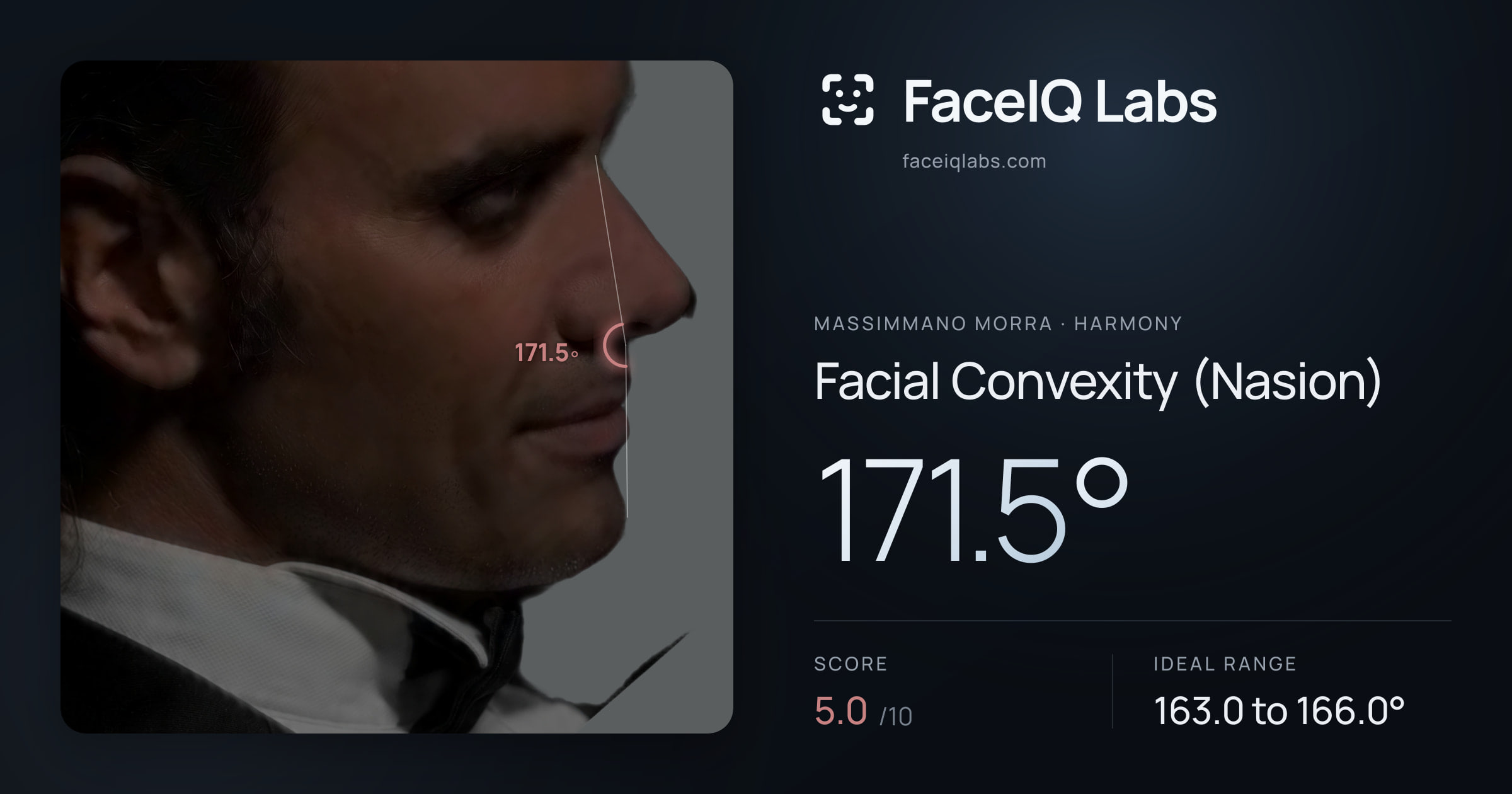 Massimmano Morra Facial Convexity (Nasion): 171.5°, drawn on the photo