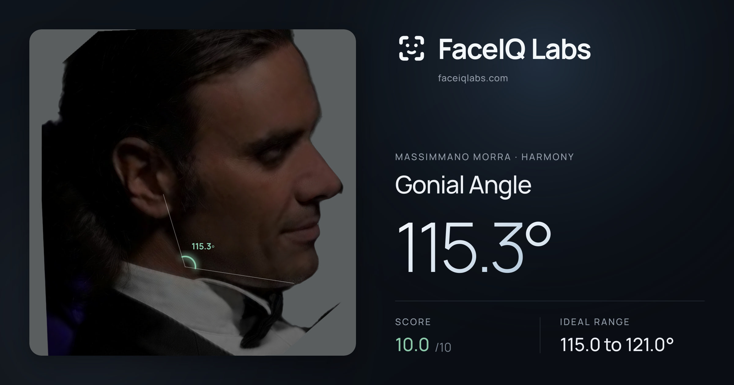 Massimmano Morra Gonial Angle: 115.3°, drawn on the photo