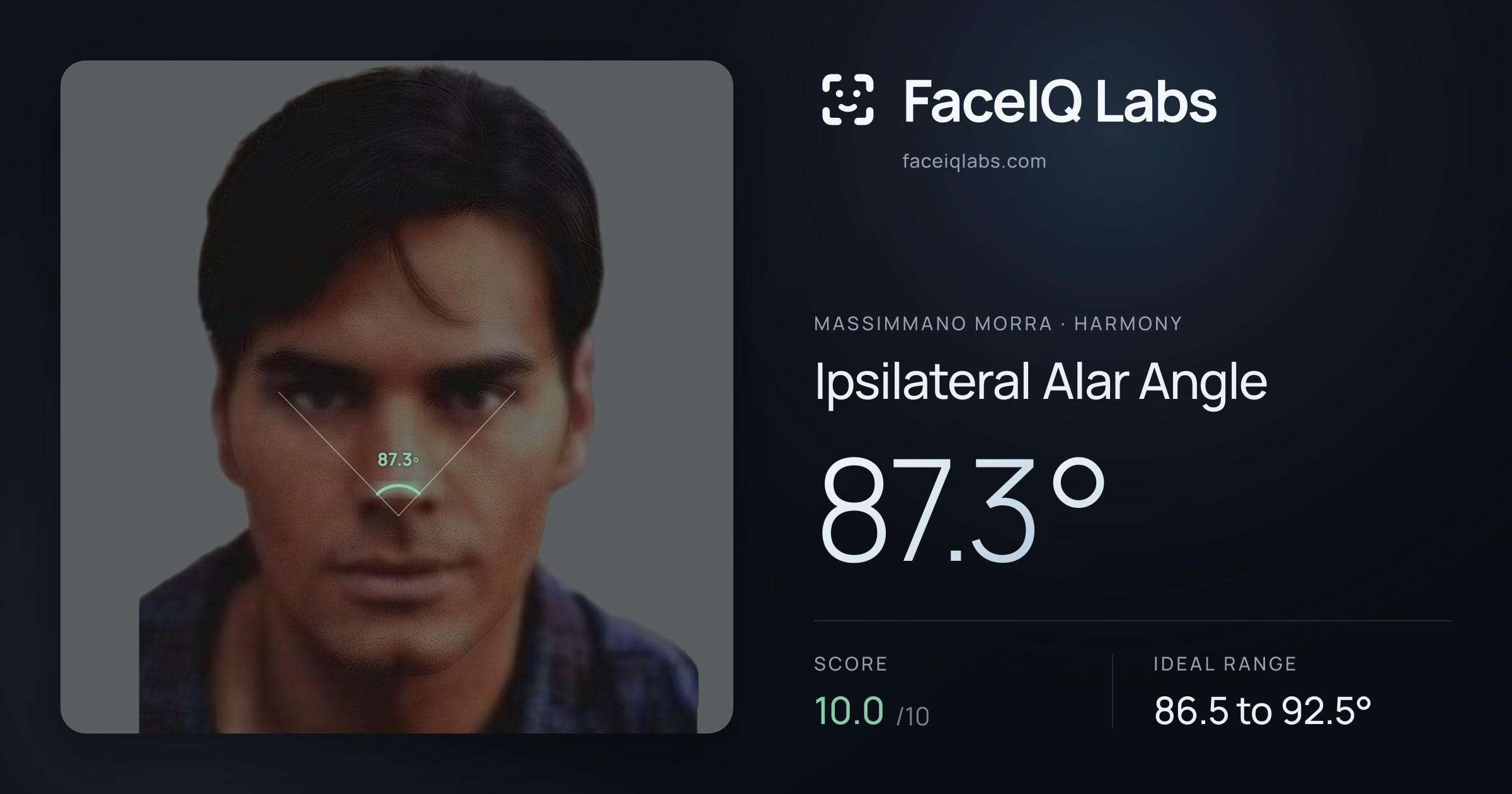 Massimmano Morra Ipsilateral Alar Angle: 87.3°, drawn on the photo