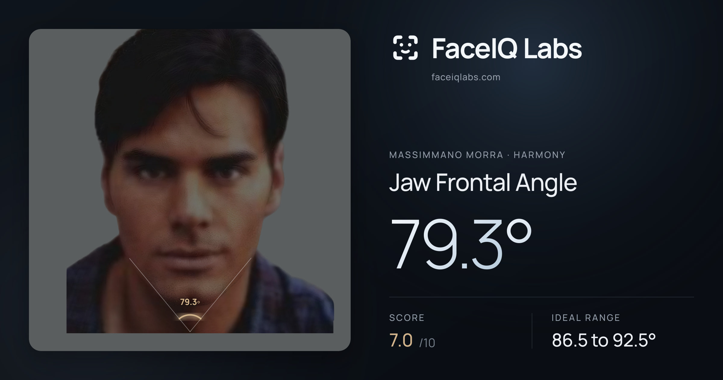 Massimmano Morra Jaw Frontal Angle: 79.3°, drawn on the photo