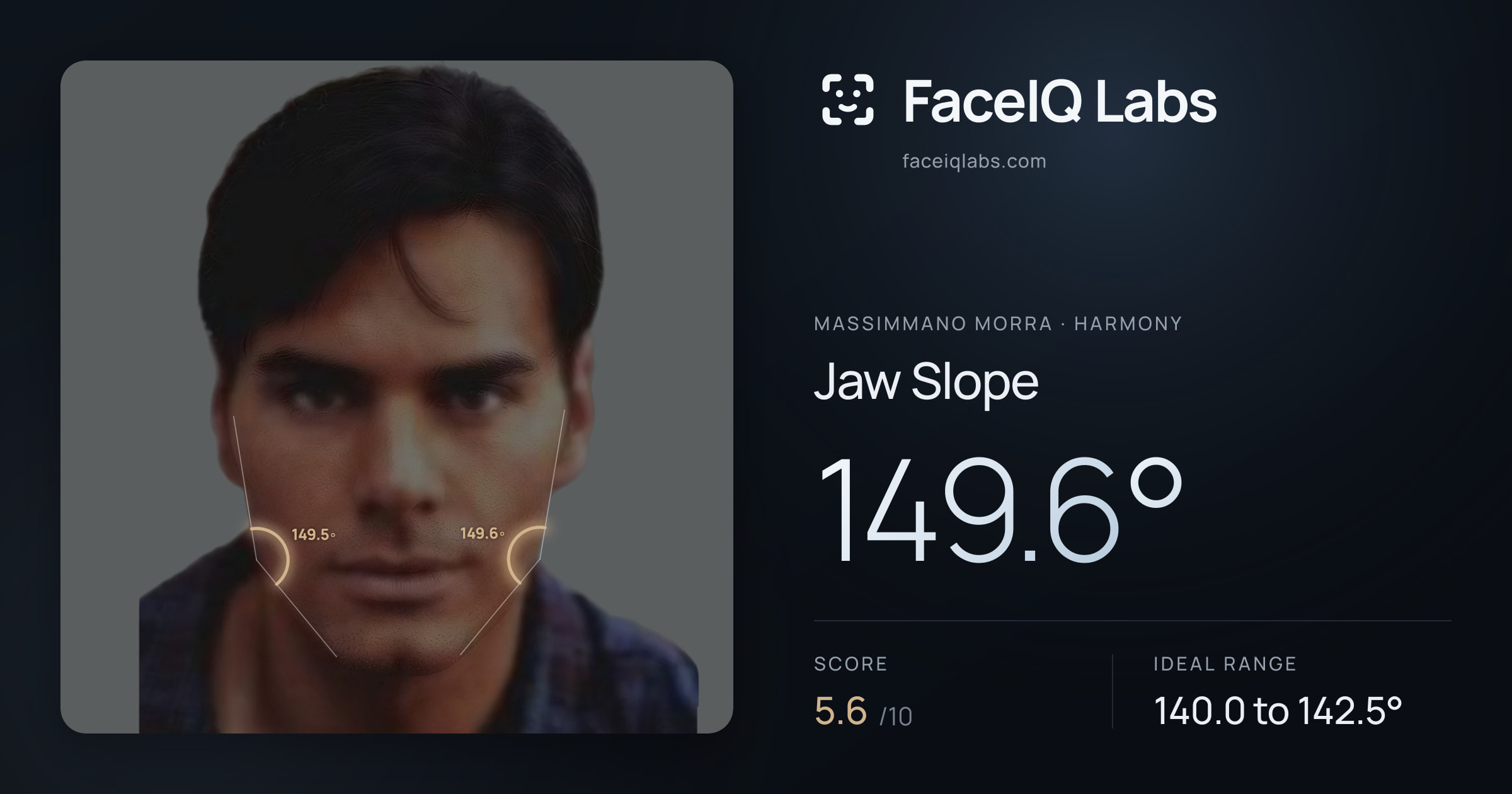Massimmano Morra Jaw Slope: 149.6°, drawn on the photo