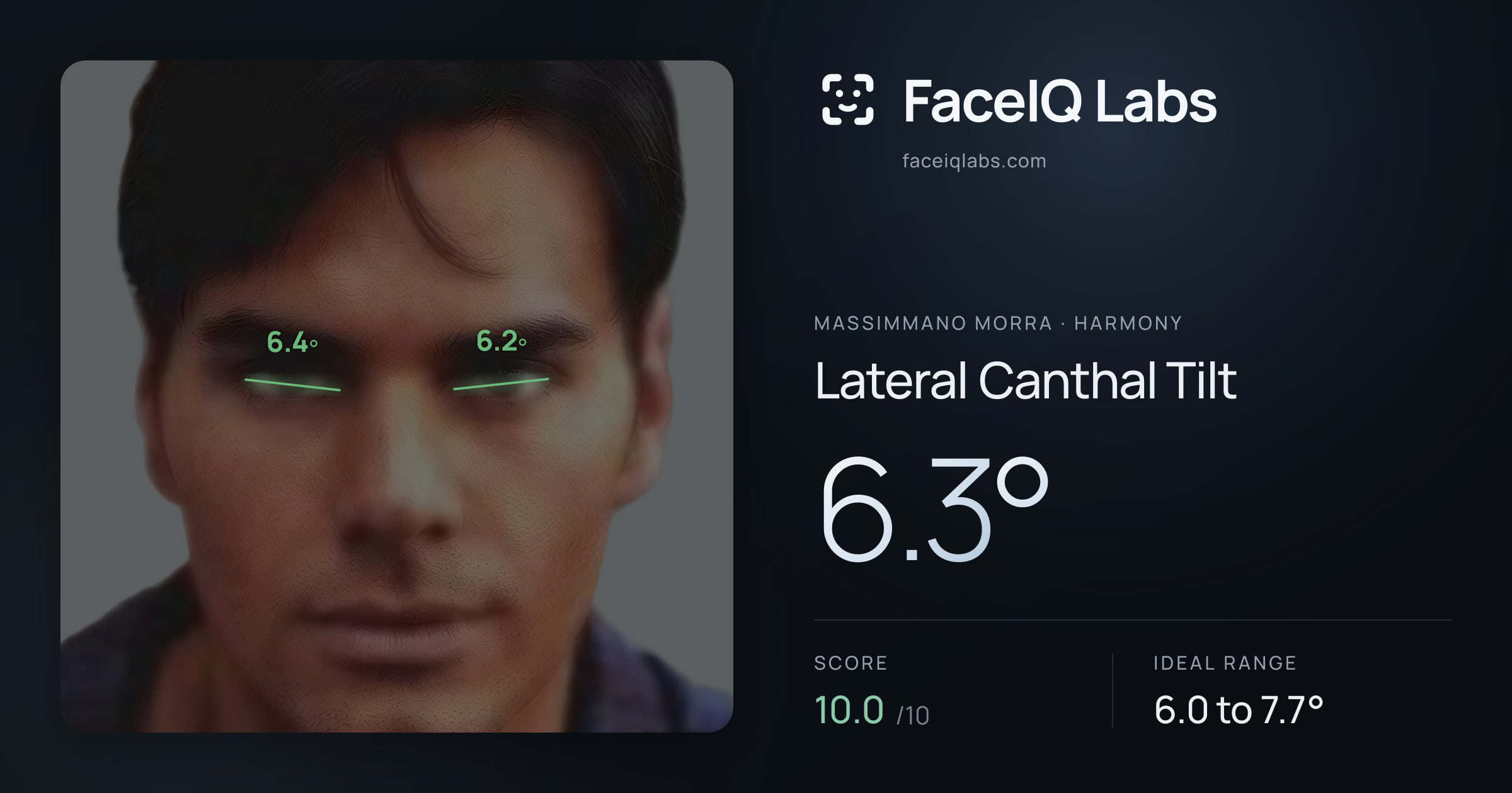 Massimmano Morra Lateral Canthal Tilt: 6.3°, drawn on the photo