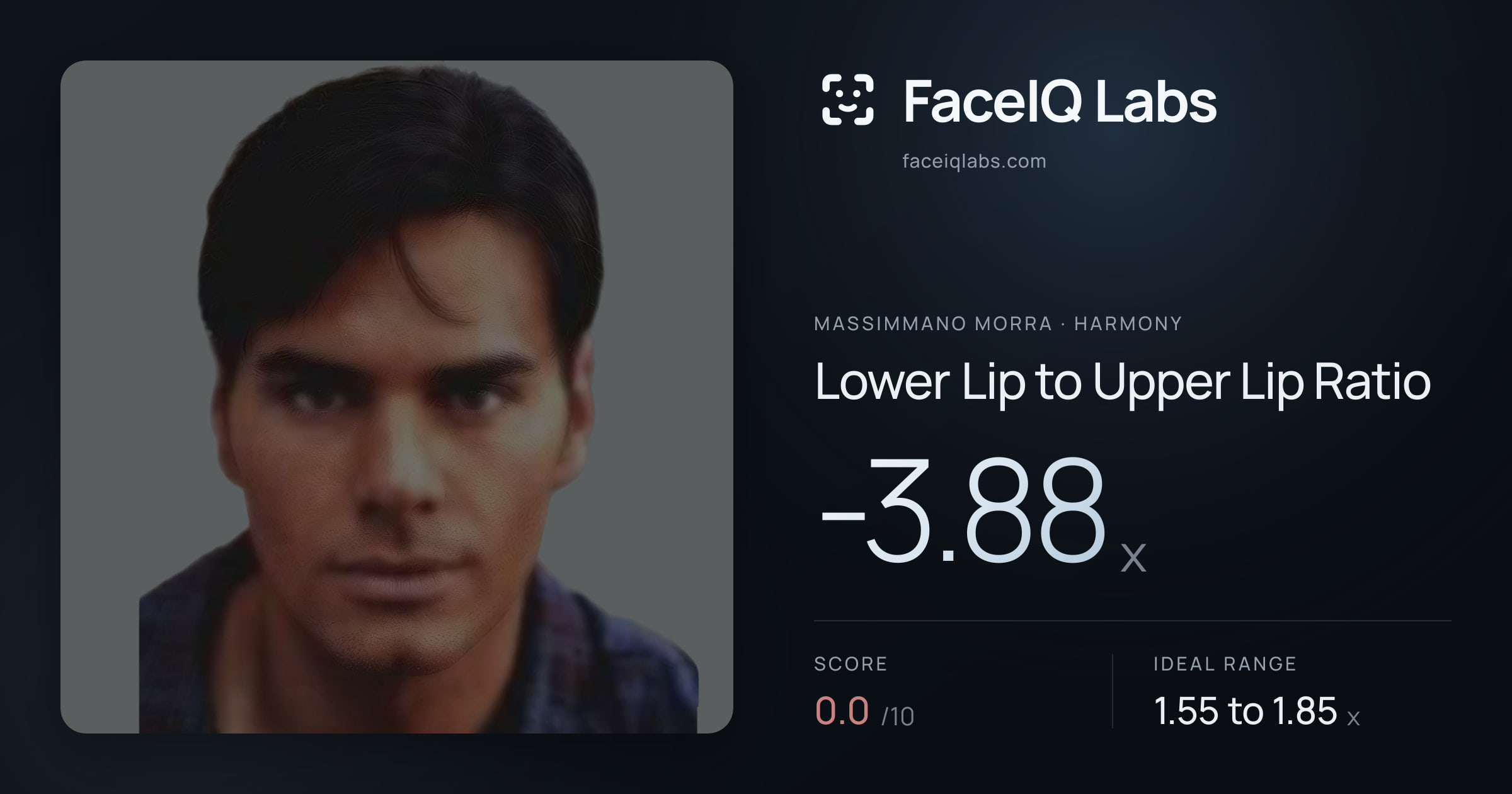 Massimmano Morra Lower Lip to Upper Lip Ratio: -3.88x, drawn on the photo