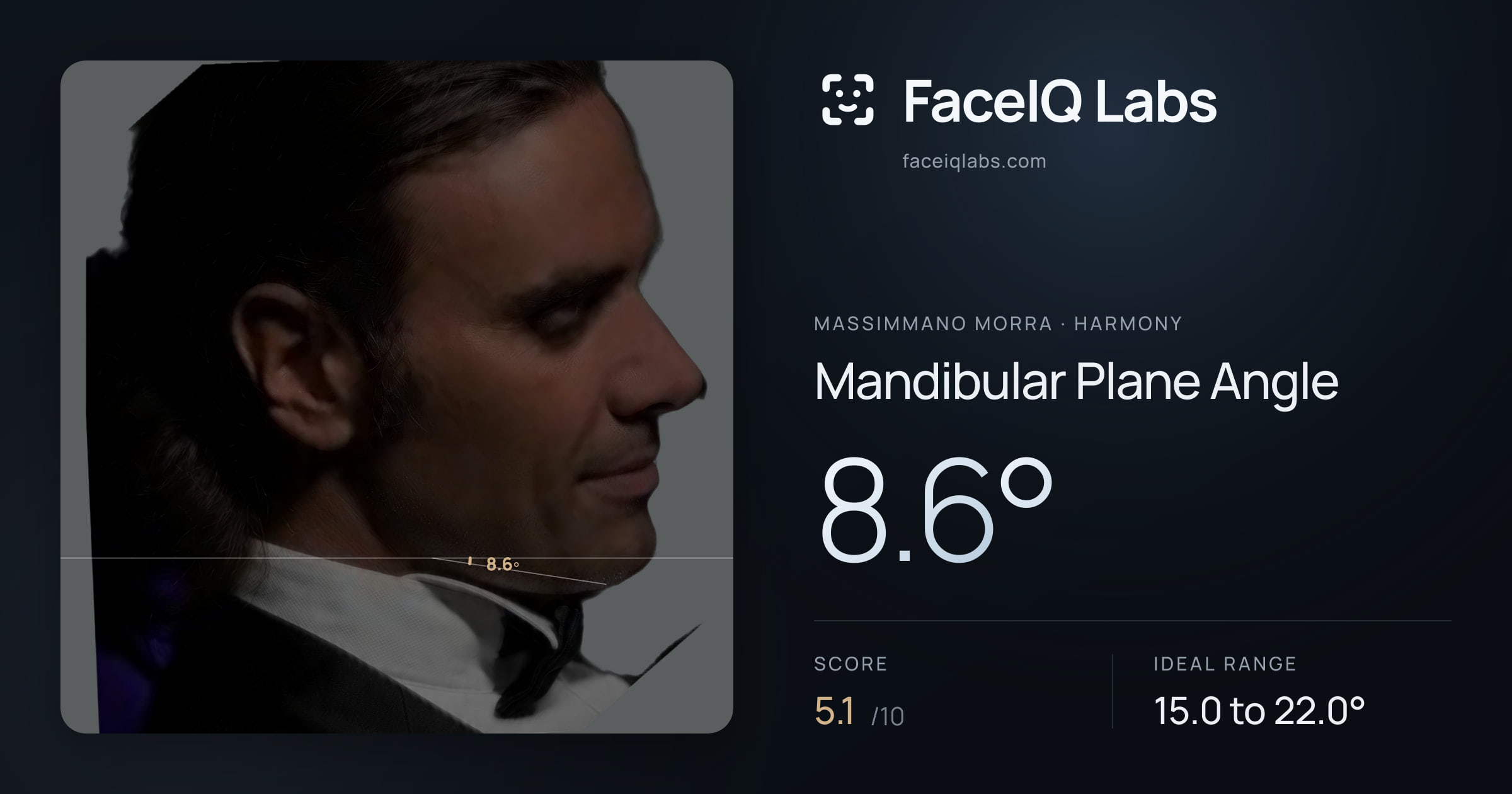 Massimmano Morra Mandibular Plane Angle: 8.6°, drawn on the photo