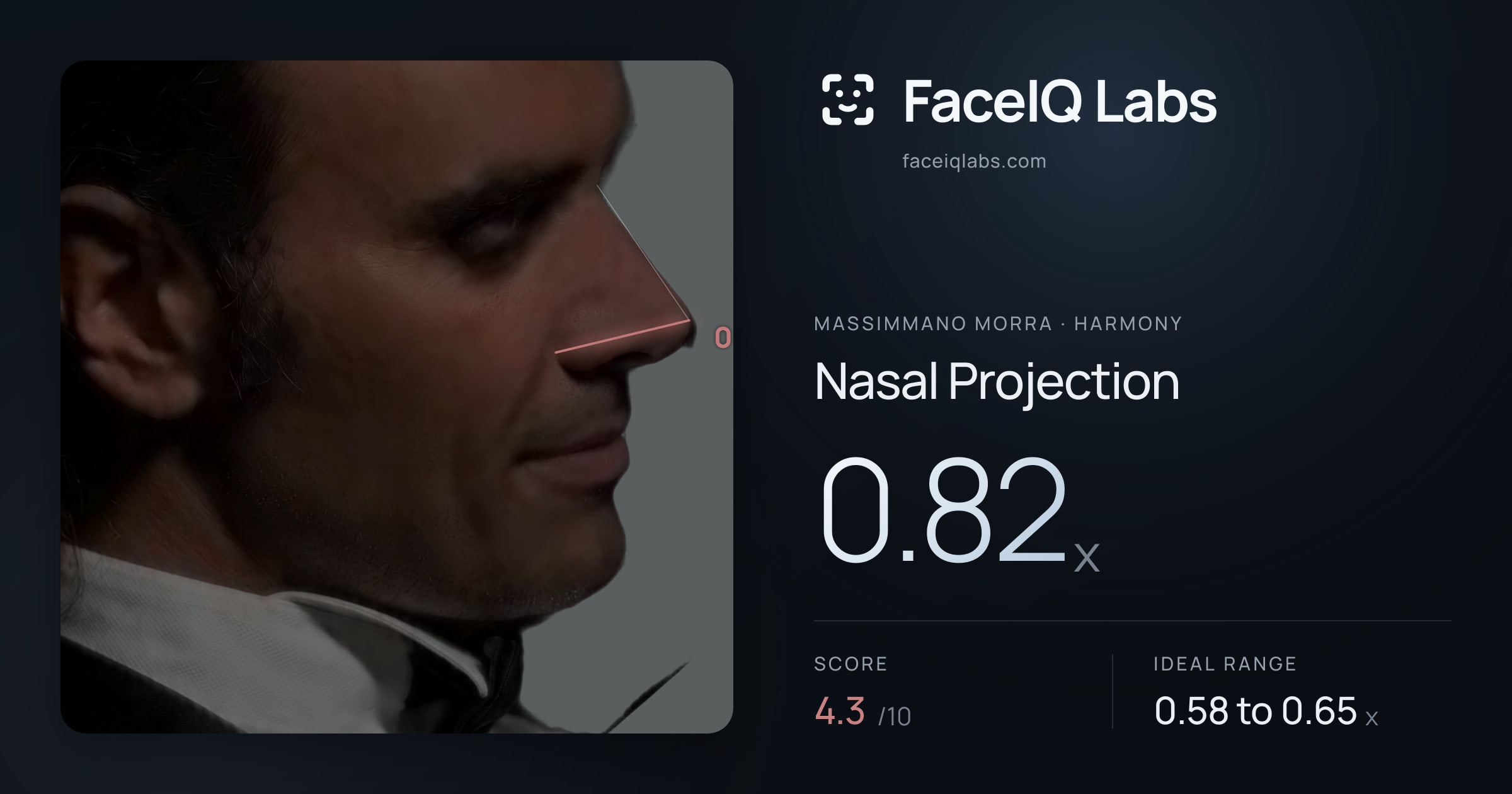 Massimmano Morra Nasal Projection: 0.82x, drawn on the photo