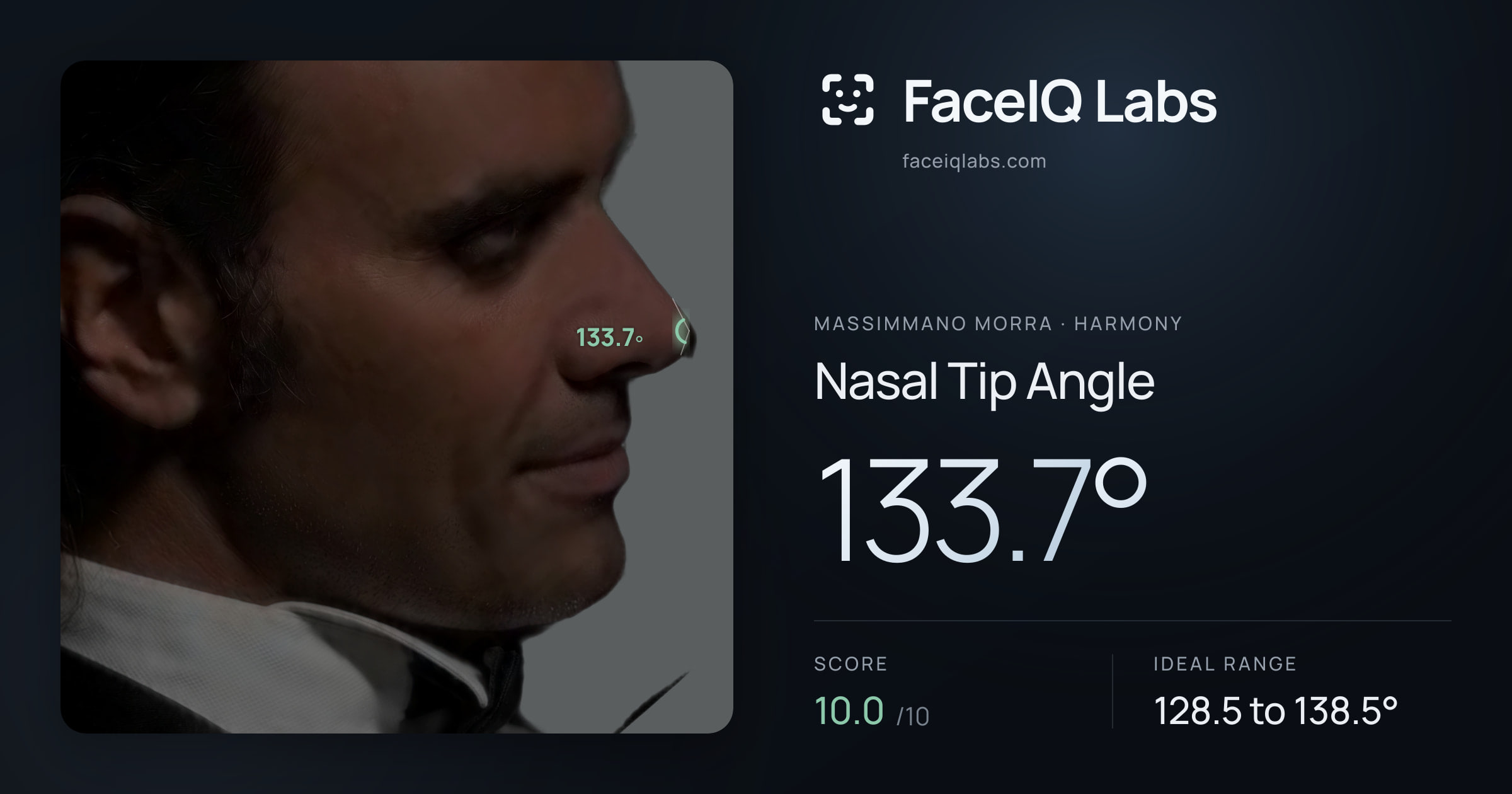 Massimmano Morra Nasal Tip Angle: 133.7°, drawn on the photo