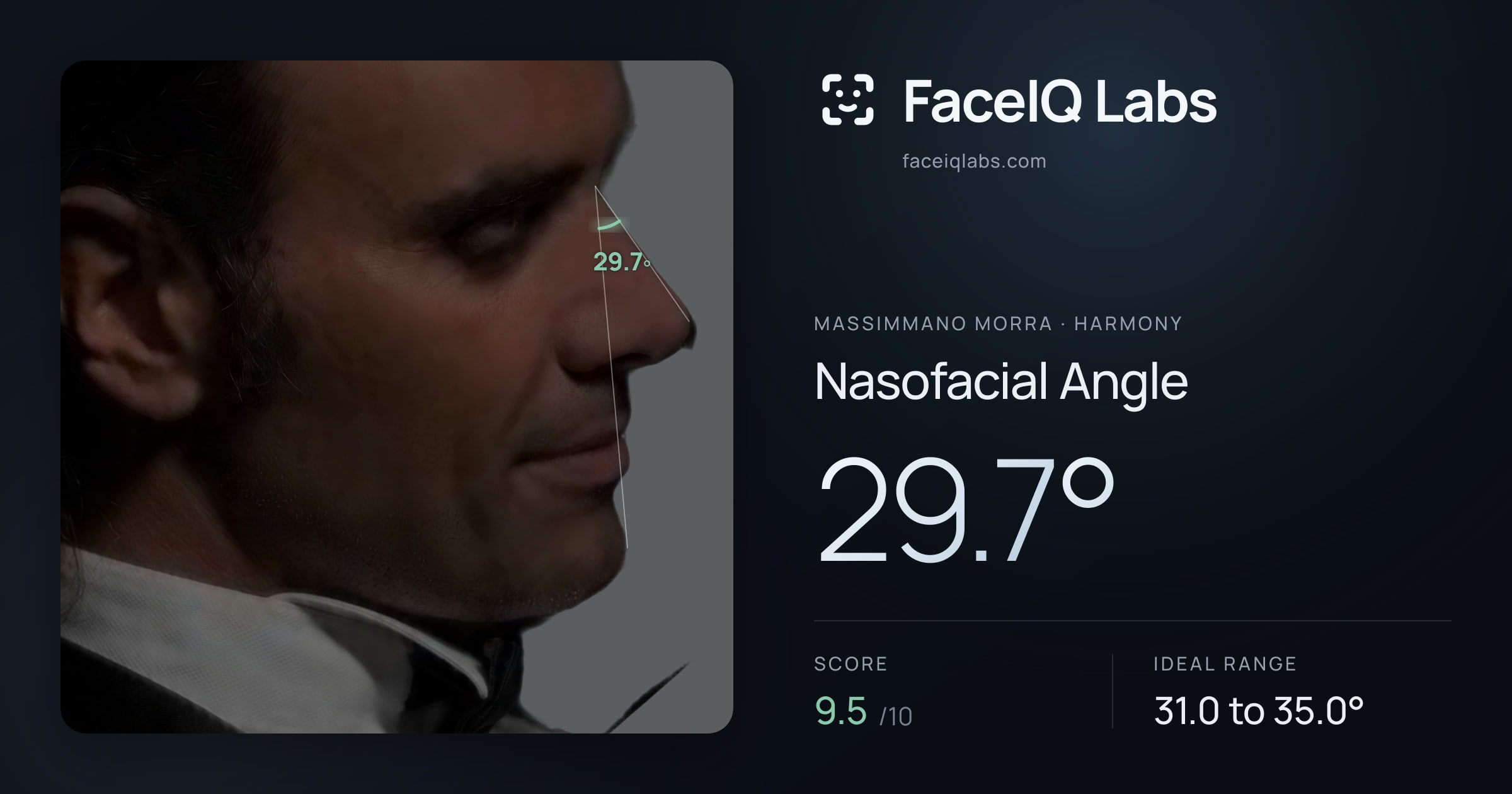Massimmano Morra Nasofacial Angle: 29.7°, drawn on the photo