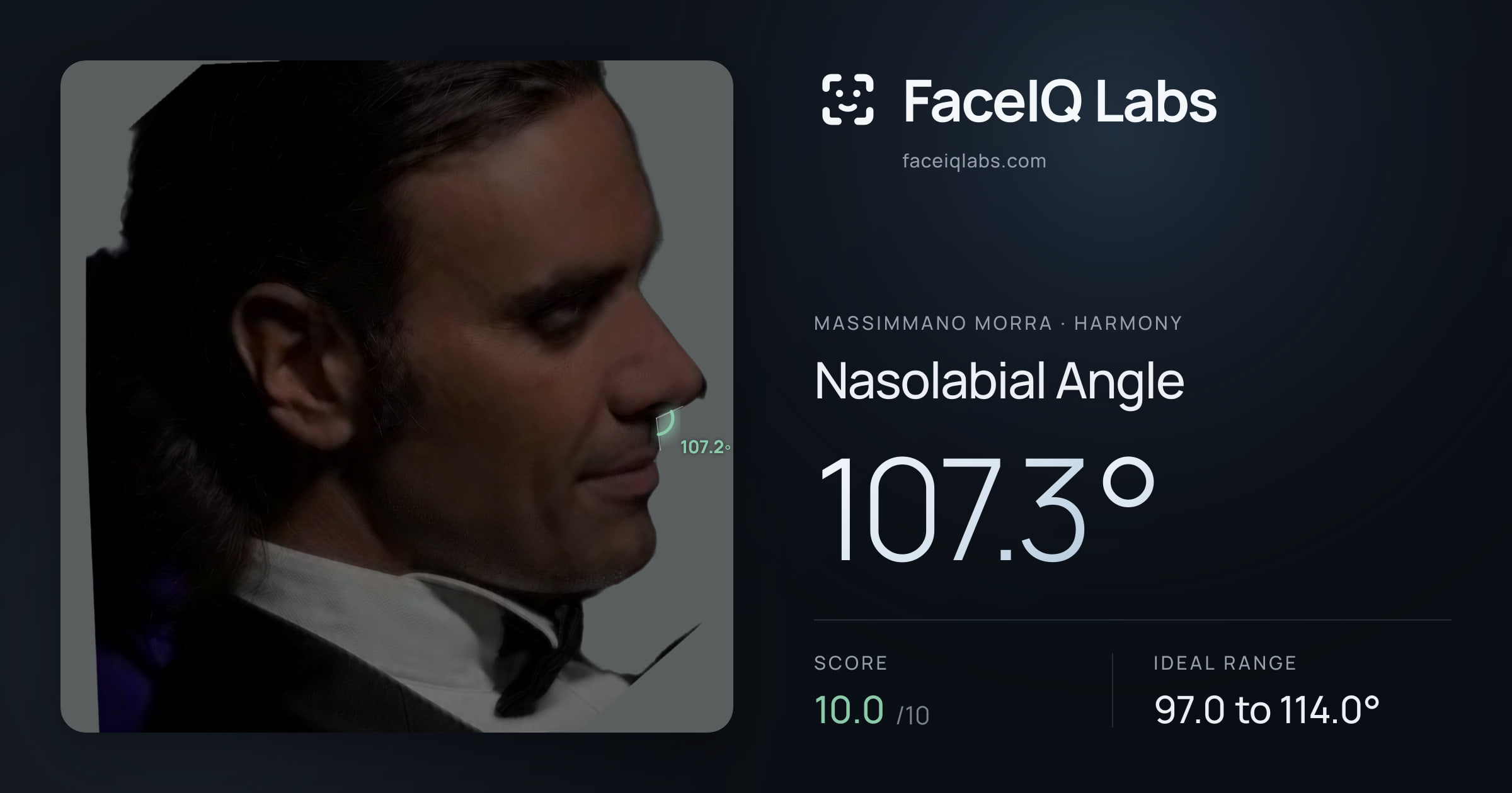 Massimmano Morra Nasolabial Angle: 107.3°, drawn on the photo