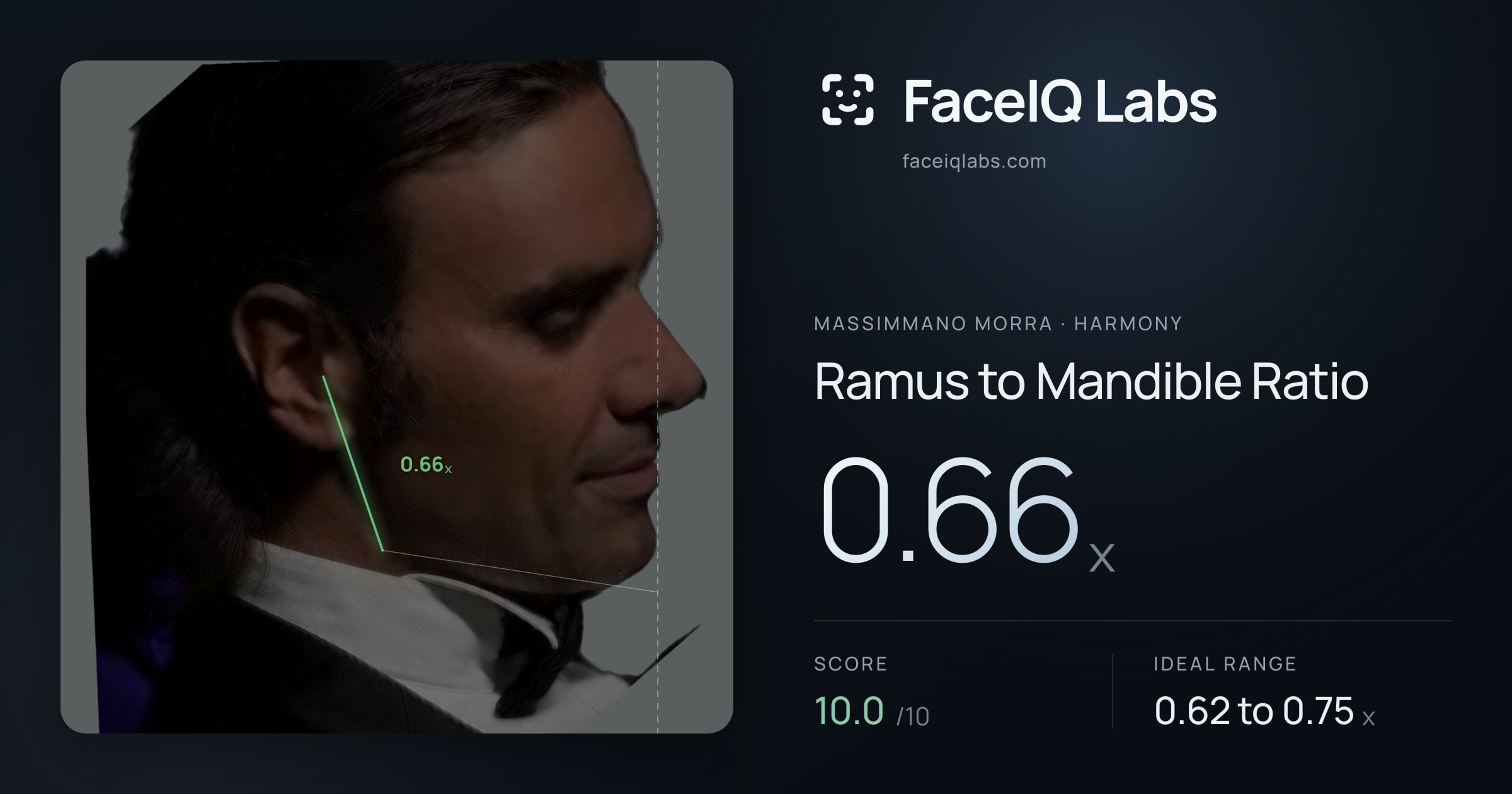 Massimmano Morra Ramus to Mandible Ratio: 0.66x, drawn on the photo