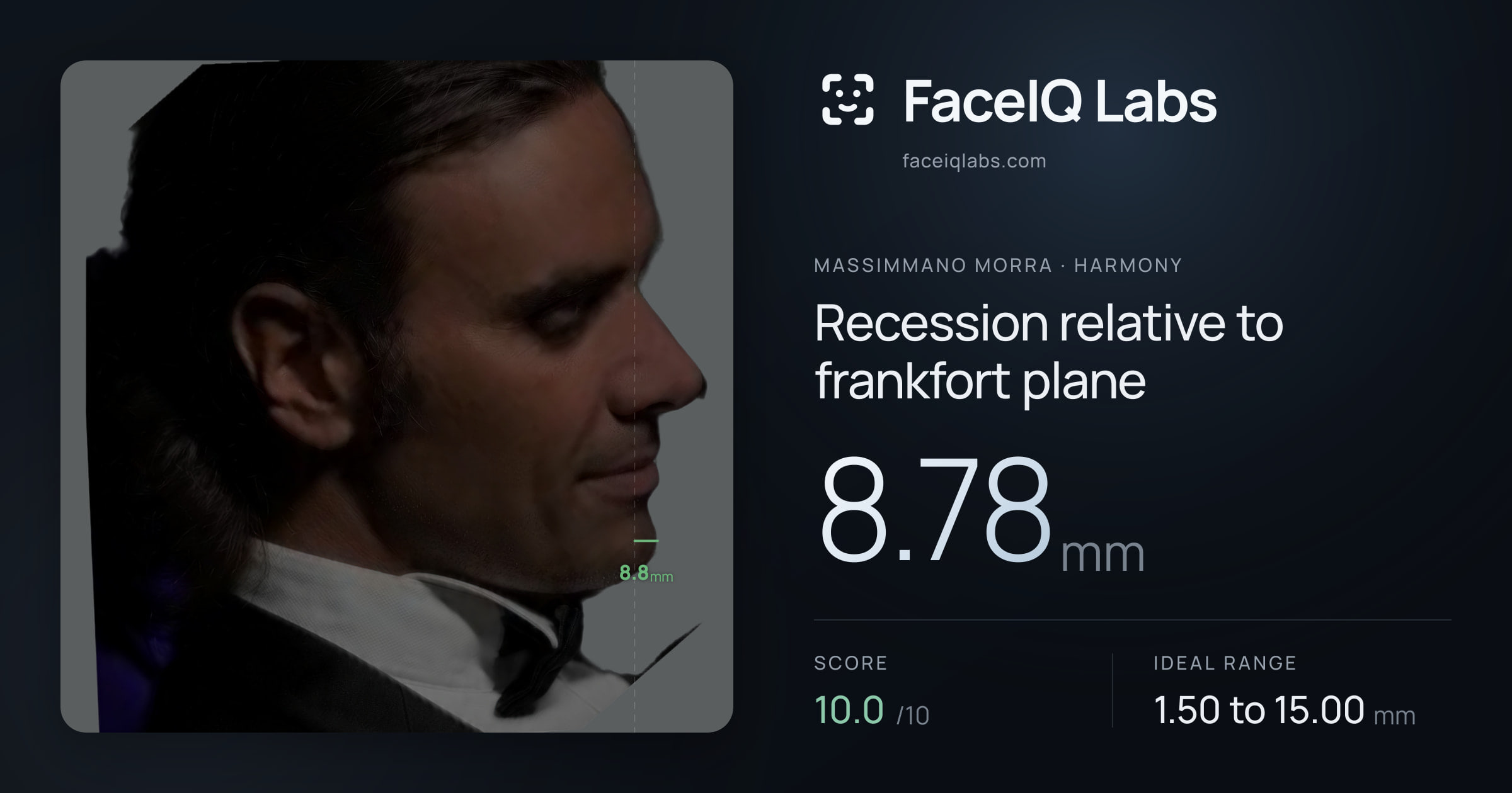 Massimmano Morra Recession relative to frankfort plane: 8.78mm, drawn on the photo