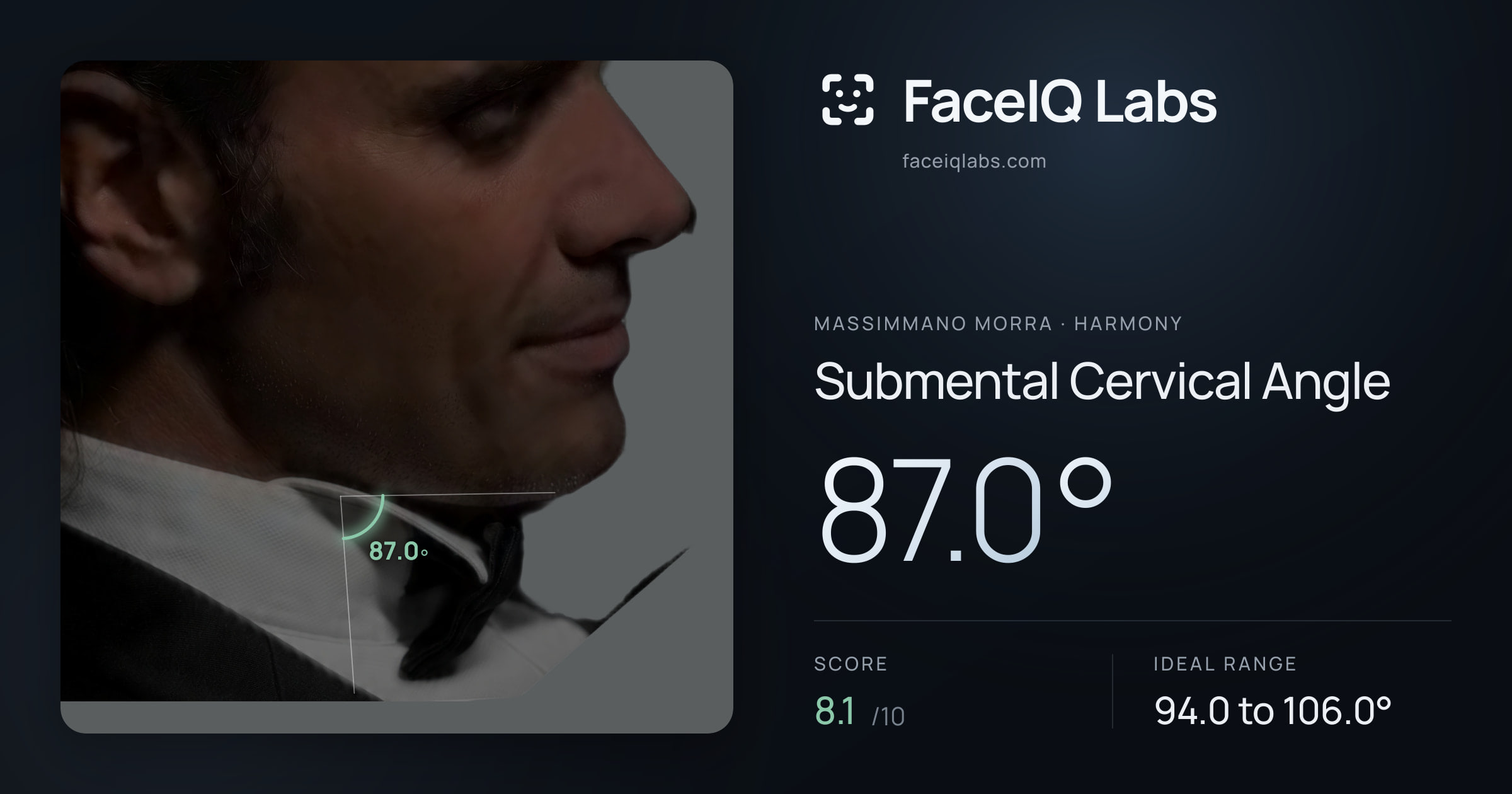 Massimmano Morra Submental Cervical Angle: 87.0°, drawn on the photo