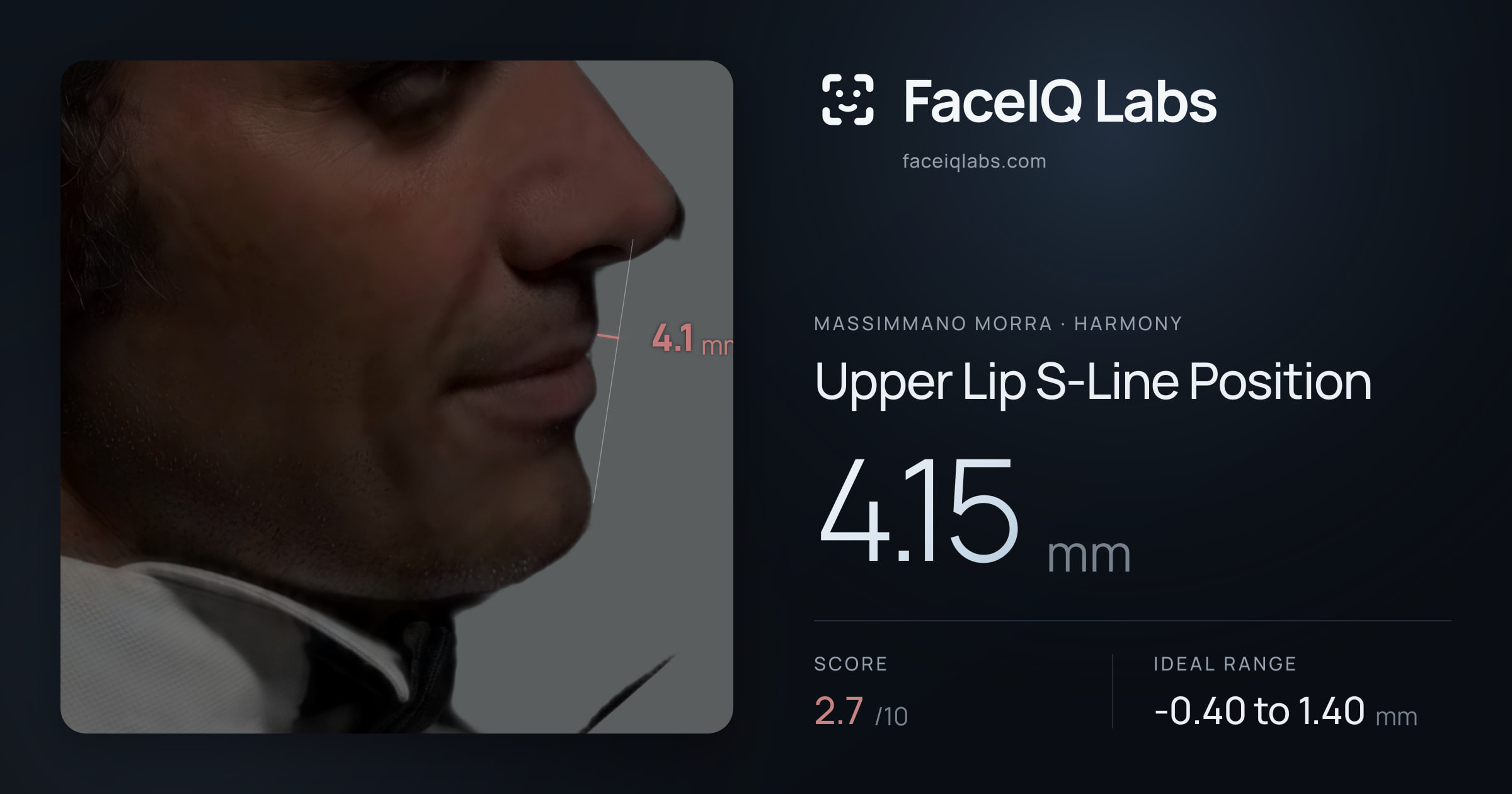 Massimmano Morra Upper Lip S-Line Position: 4.15mm, drawn on the photo