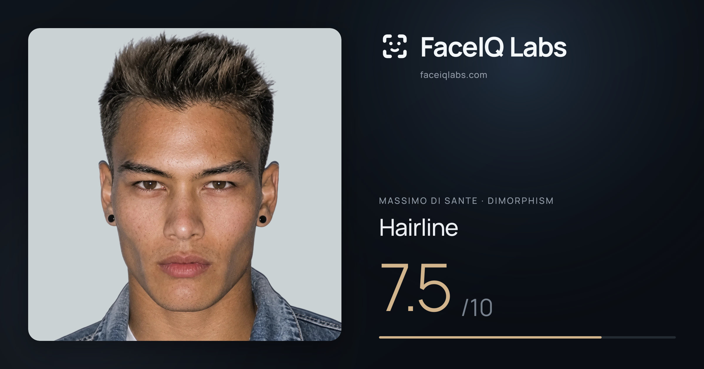 Massimo di Sante Hairline: 7.5/10, drawn on the photo