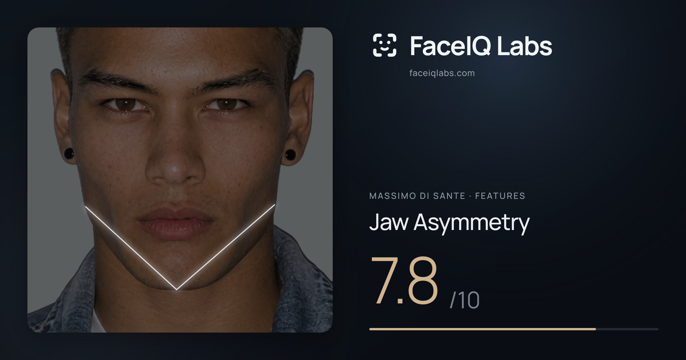 Massimo di Sante Jaw Asymmetry: 7.8/10, drawn on the photo