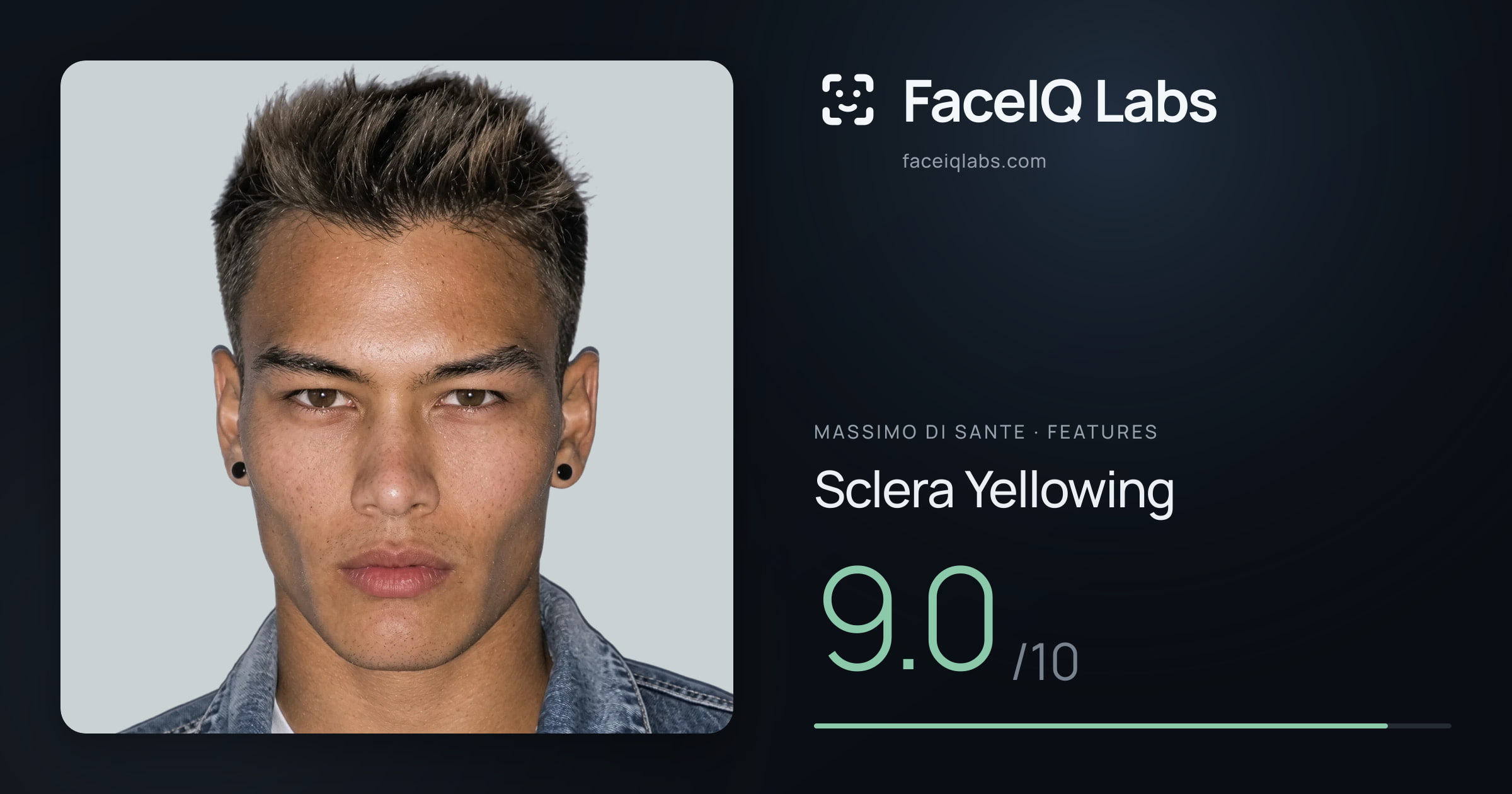 Massimo di Sante Sclera Yellowing: 9.0/10, drawn on the photo