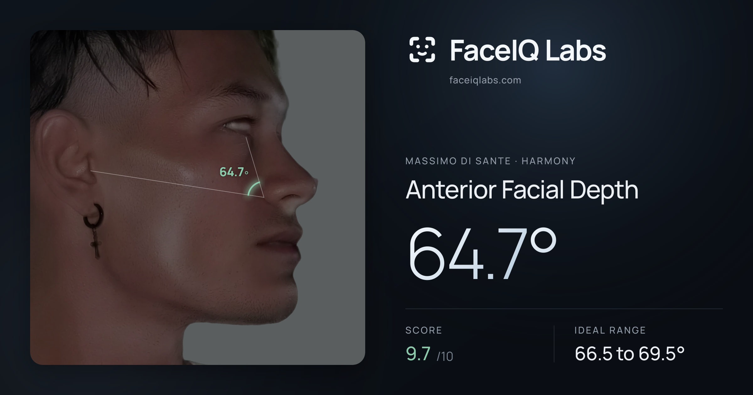 Massimo di Sante Anterior Facial Depth: 64.7°, drawn on the photo