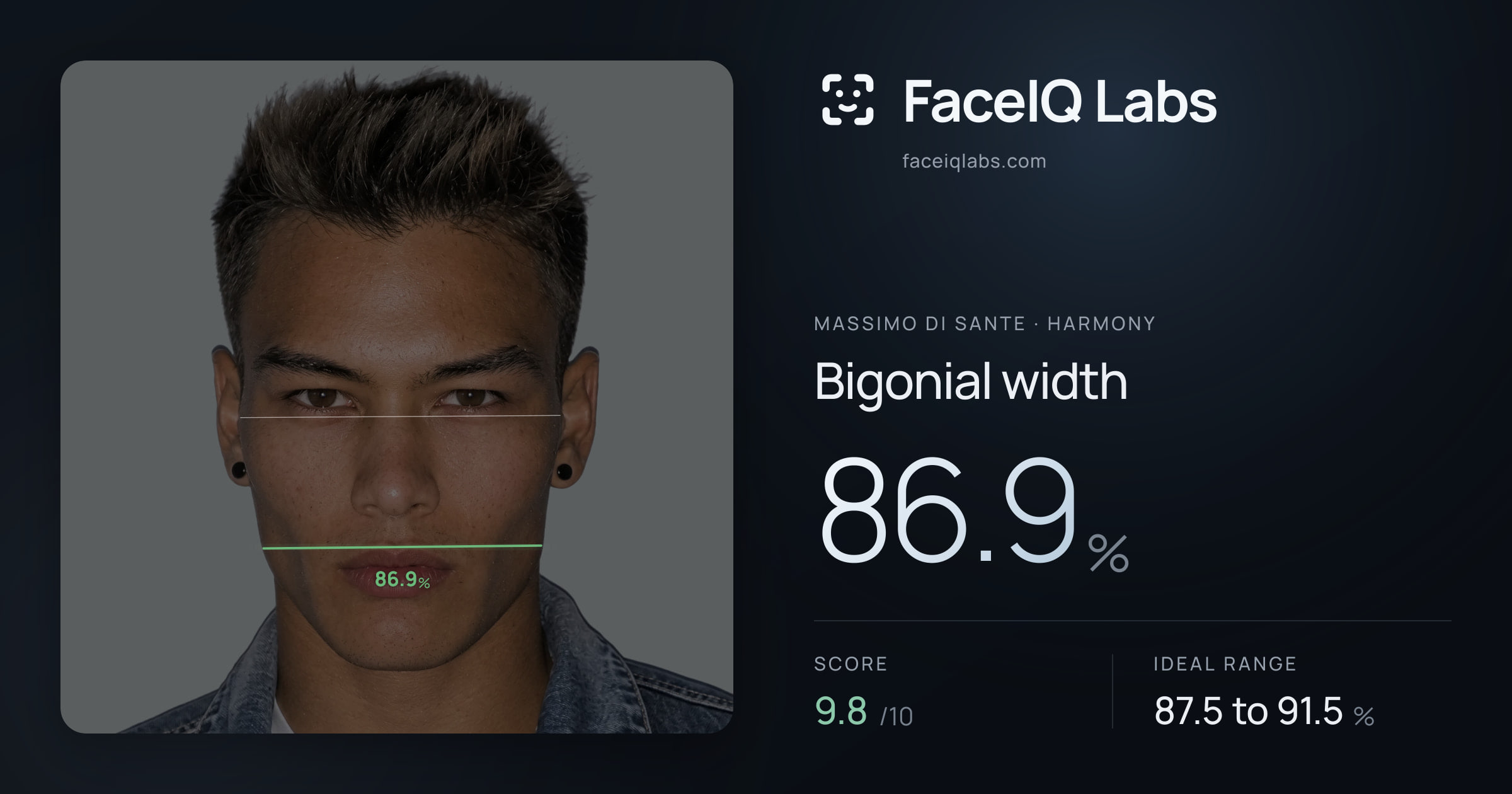 Massimo di Sante Bigonial width: 86.9%, drawn on the photo