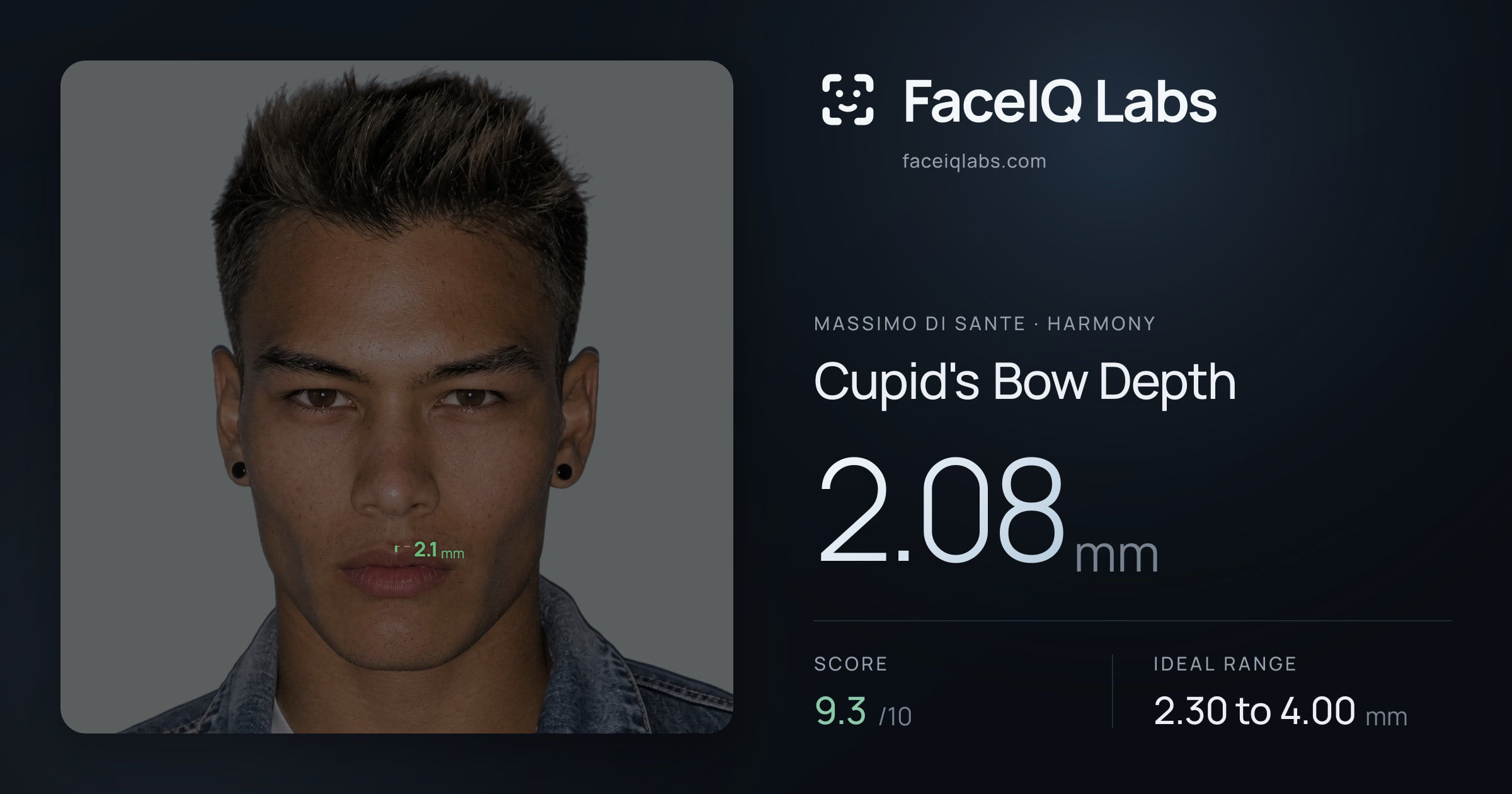 Massimo di Sante Cupid's Bow Depth: 2.08mm, drawn on the photo