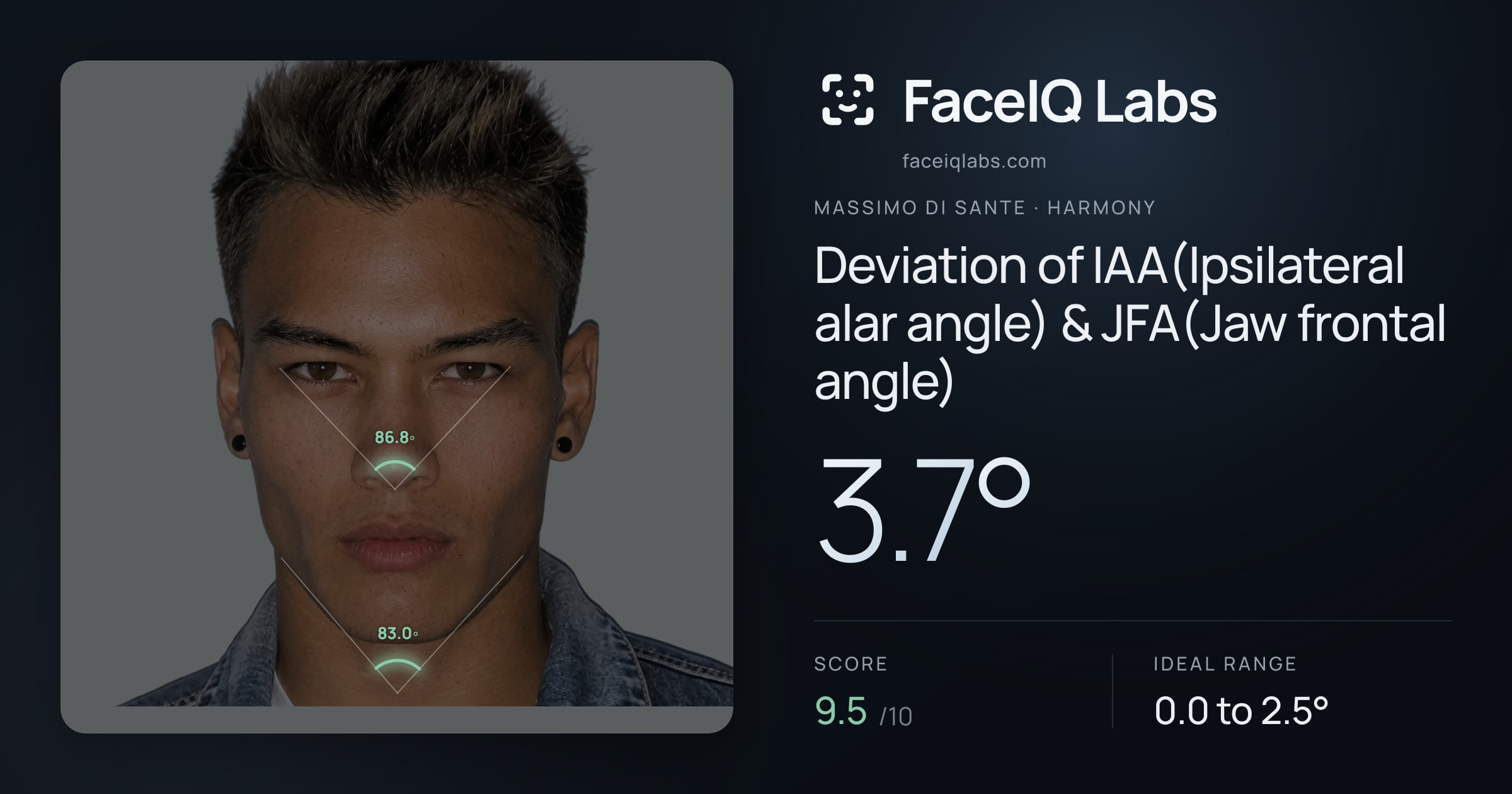 Massimo di Sante Deviation of IAA(Ipsilateral alar angle) & JFA(Jaw frontal angle): 3.7°, drawn on the photo