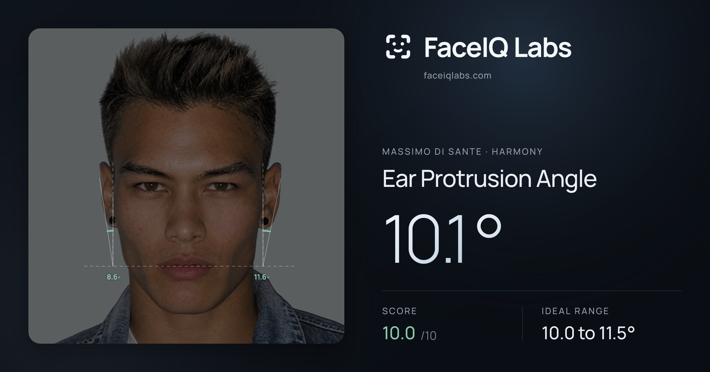 Massimo di Sante Ear Protrusion Angle: 10.1°, drawn on the photo