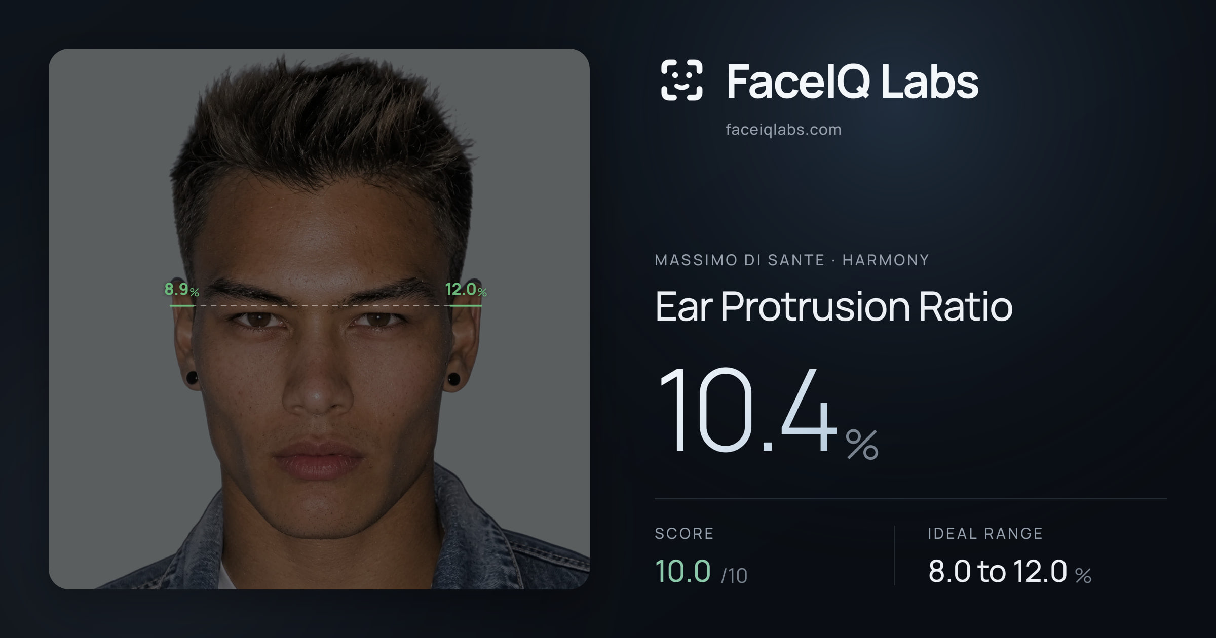 Massimo di Sante Ear Protrusion Ratio: 10.4%, drawn on the photo