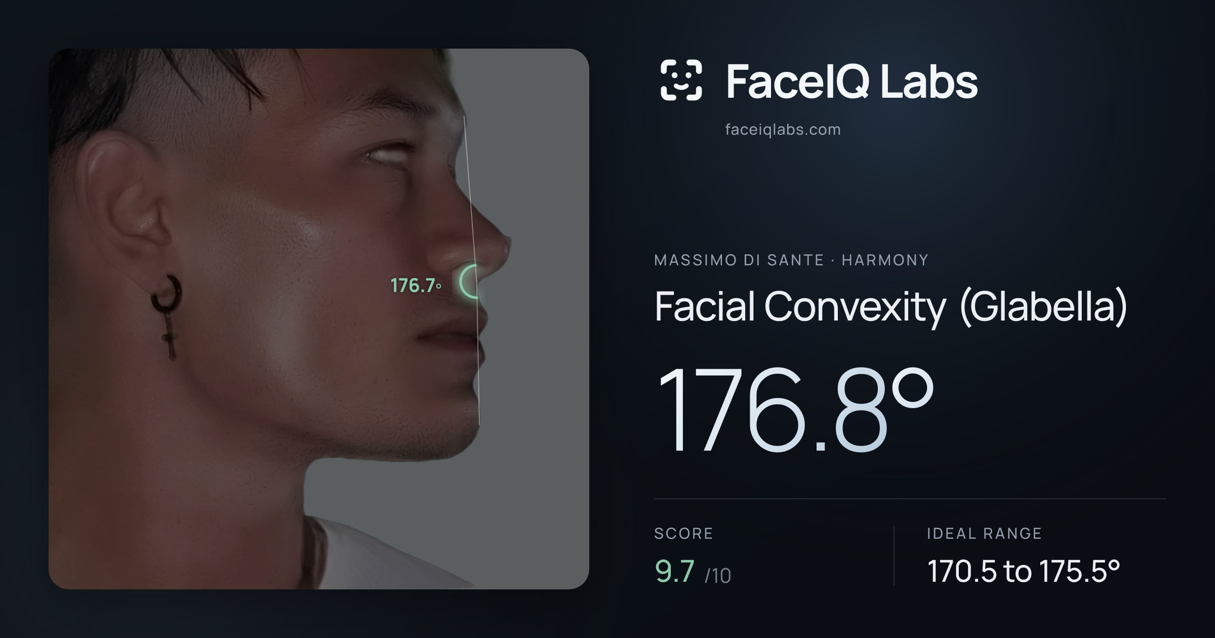 Massimo di Sante Facial Convexity (Glabella): 176.8°, drawn on the photo