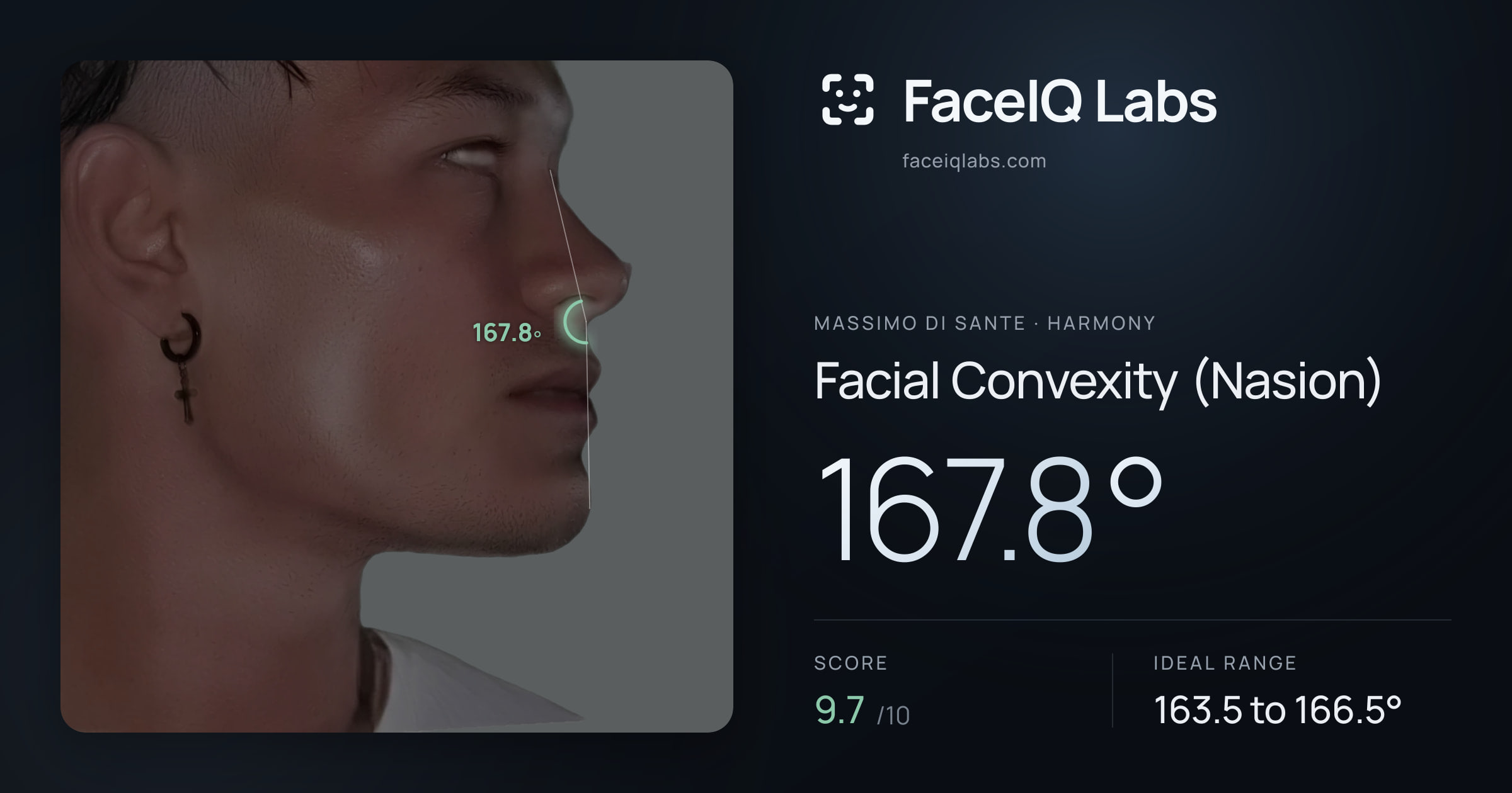 Massimo di Sante Facial Convexity (Nasion): 167.8°, drawn on the photo