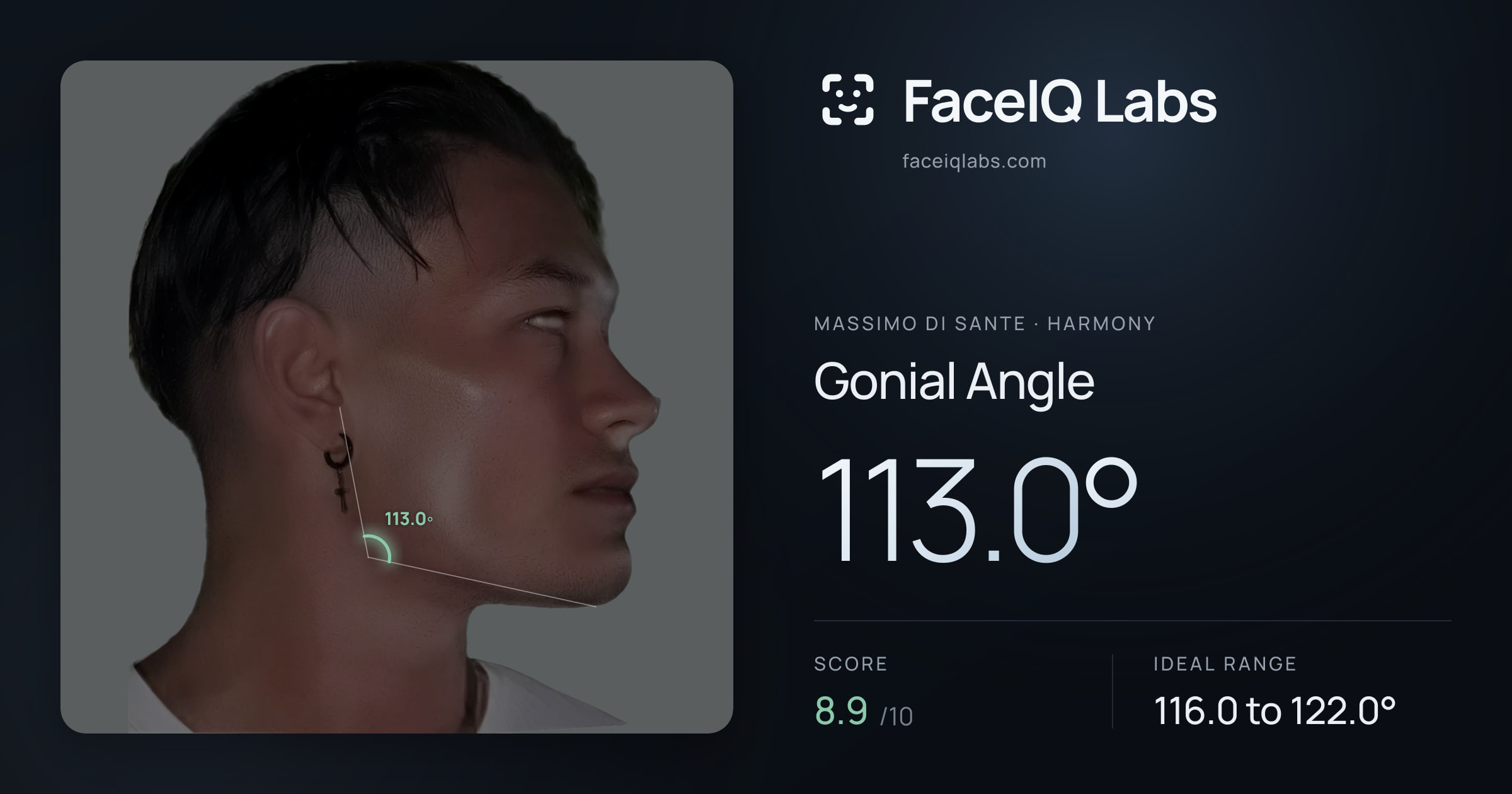 Massimo di Sante Gonial Angle: 113.0°, drawn on the photo