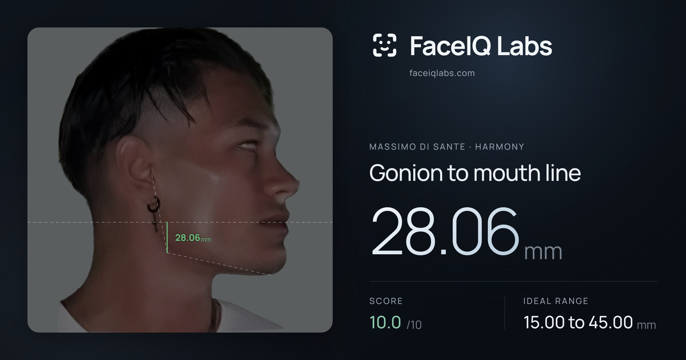 Massimo di Sante Gonion to mouth line: 28.06mm, drawn on the photo