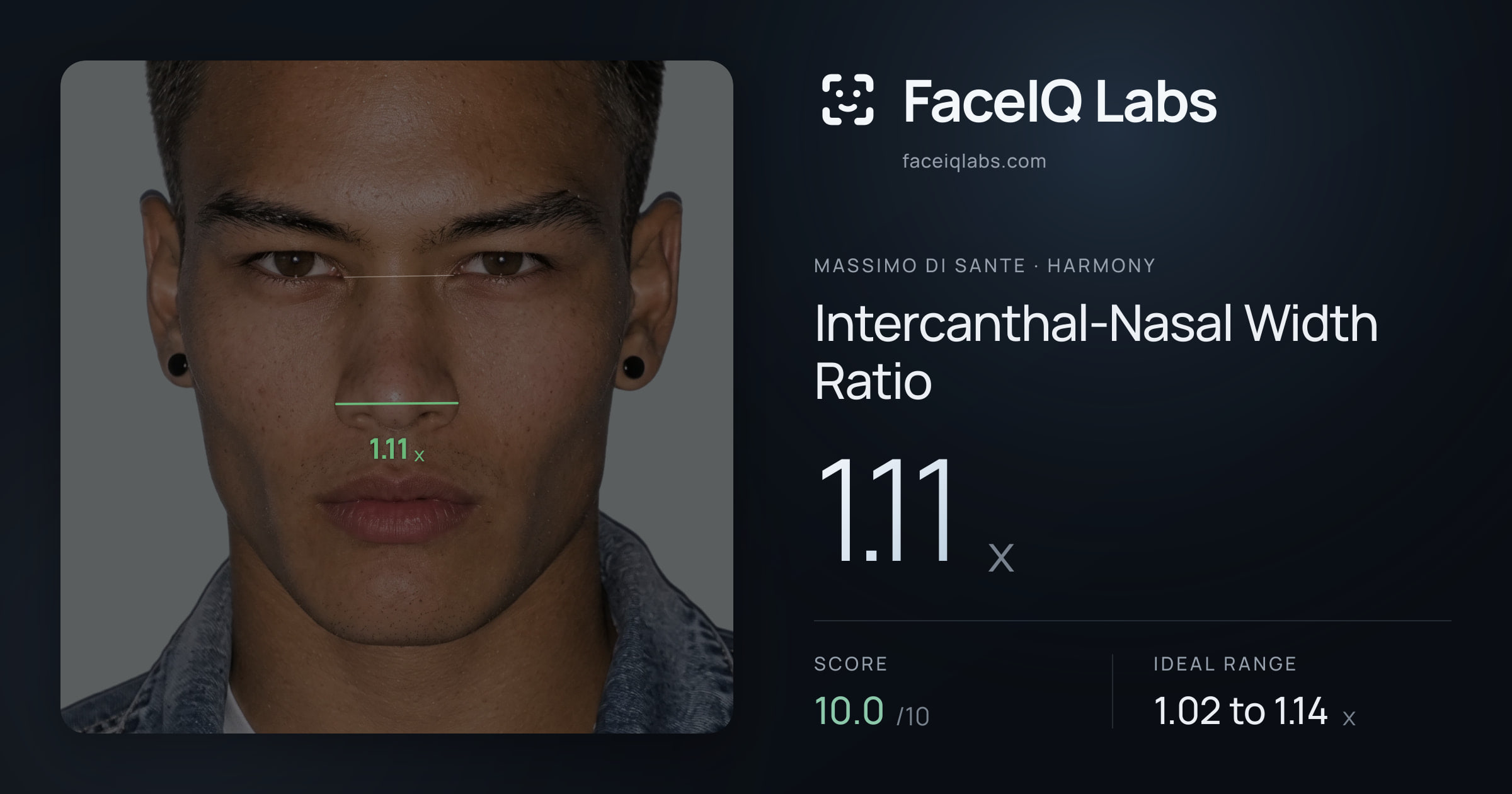 Massimo di Sante Intercanthal-Nasal Width Ratio: 1.11x, drawn on the photo