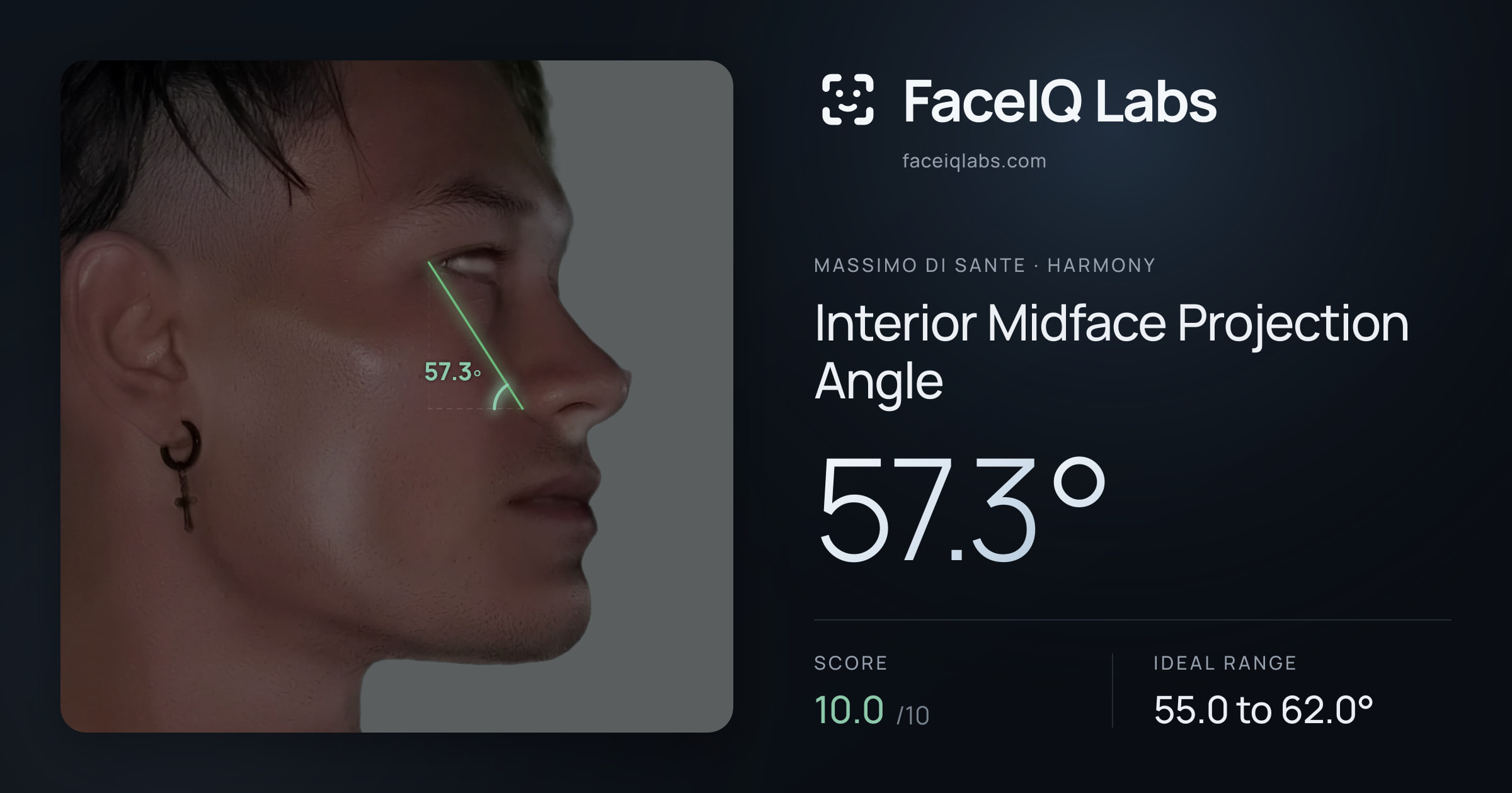 Massimo di Sante Interior Midface Projection Angle: 57.3°, drawn on the photo