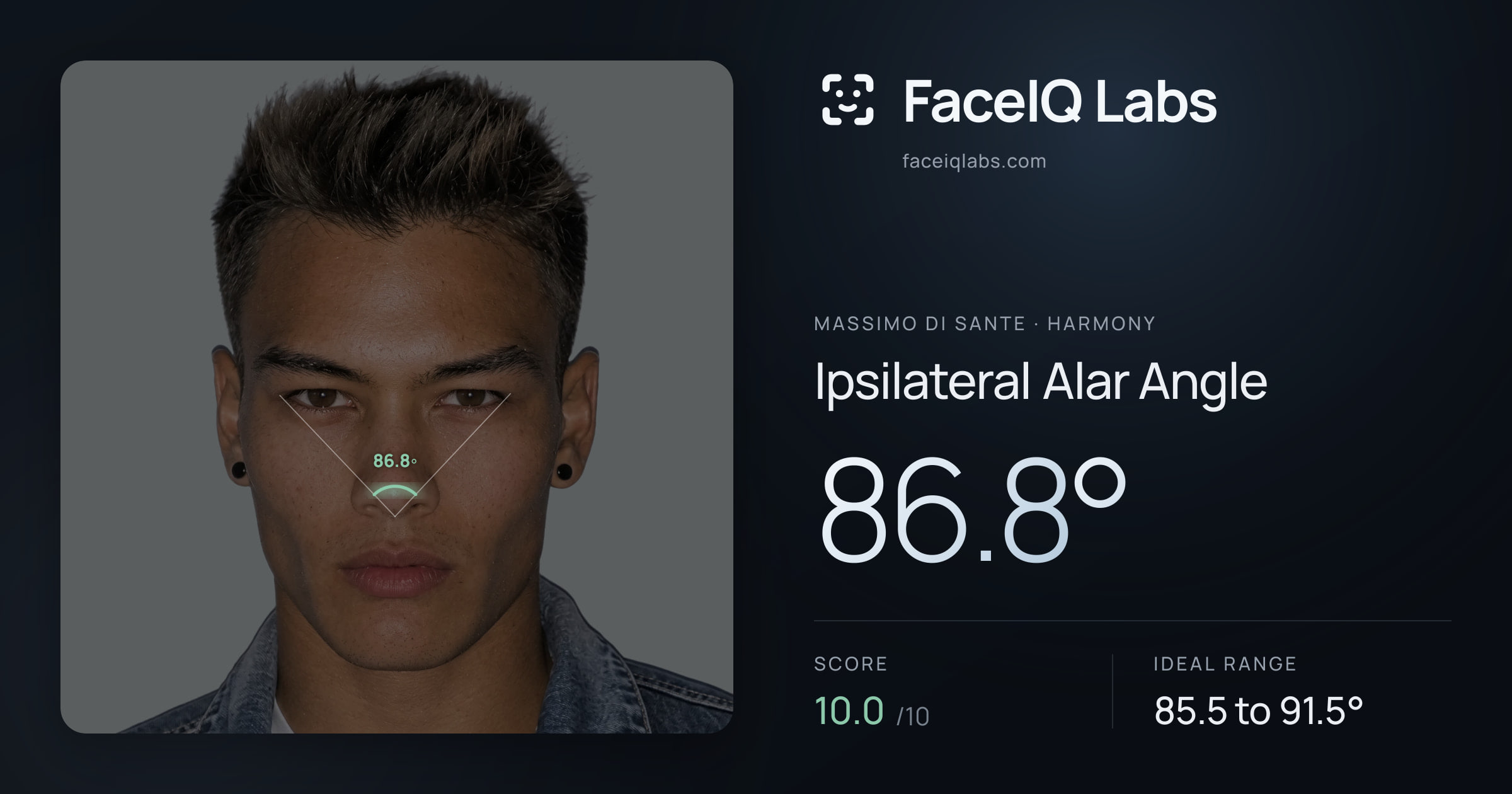 Massimo di Sante Ipsilateral Alar Angle: 86.8°, drawn on the photo