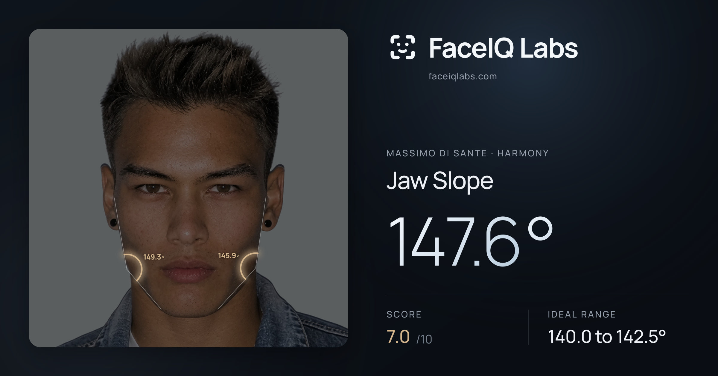 Massimo di Sante Jaw Slope: 147.6°, drawn on the photo