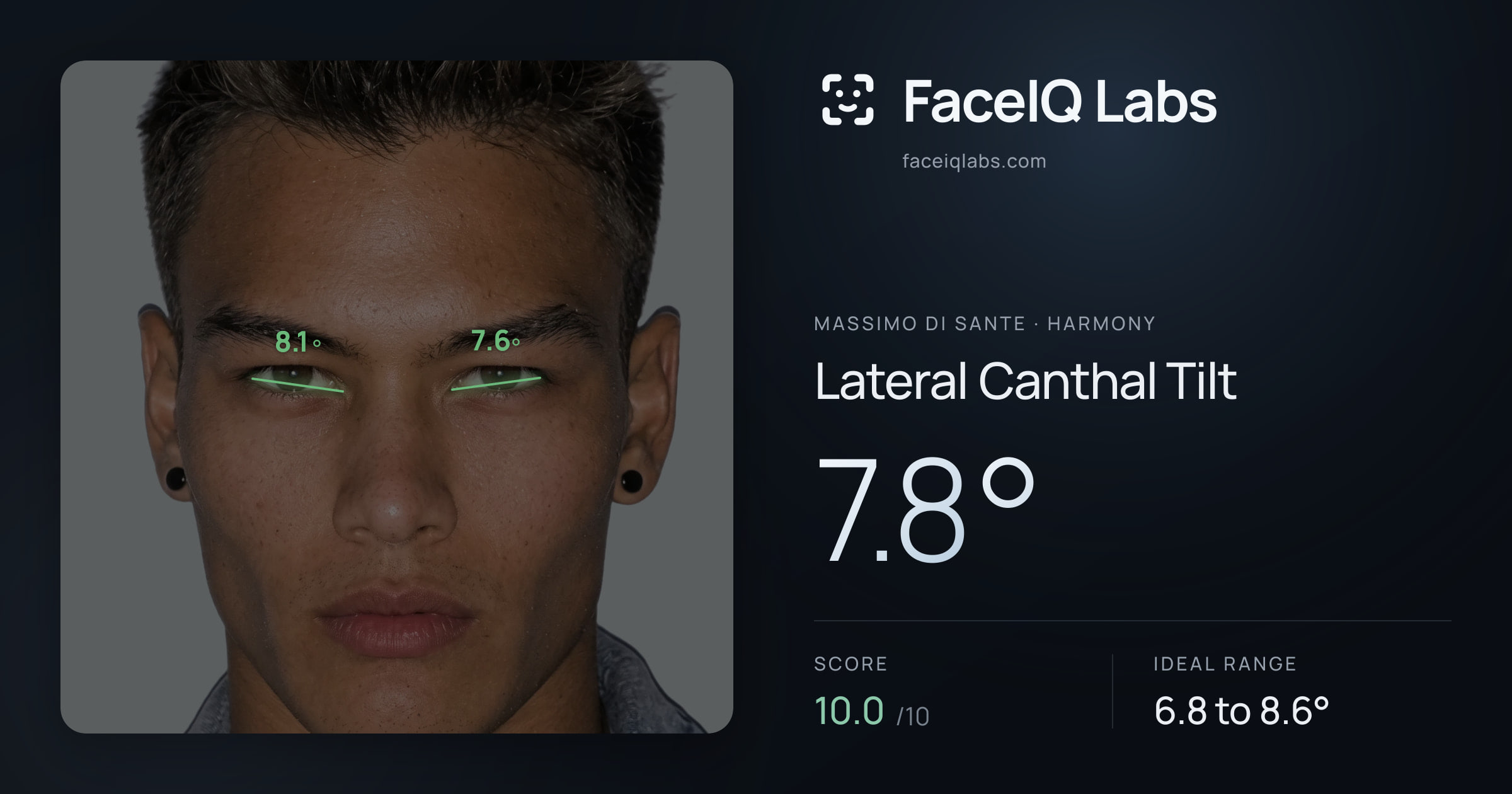 Massimo di Sante Lateral Canthal Tilt: 7.8°, drawn on the photo