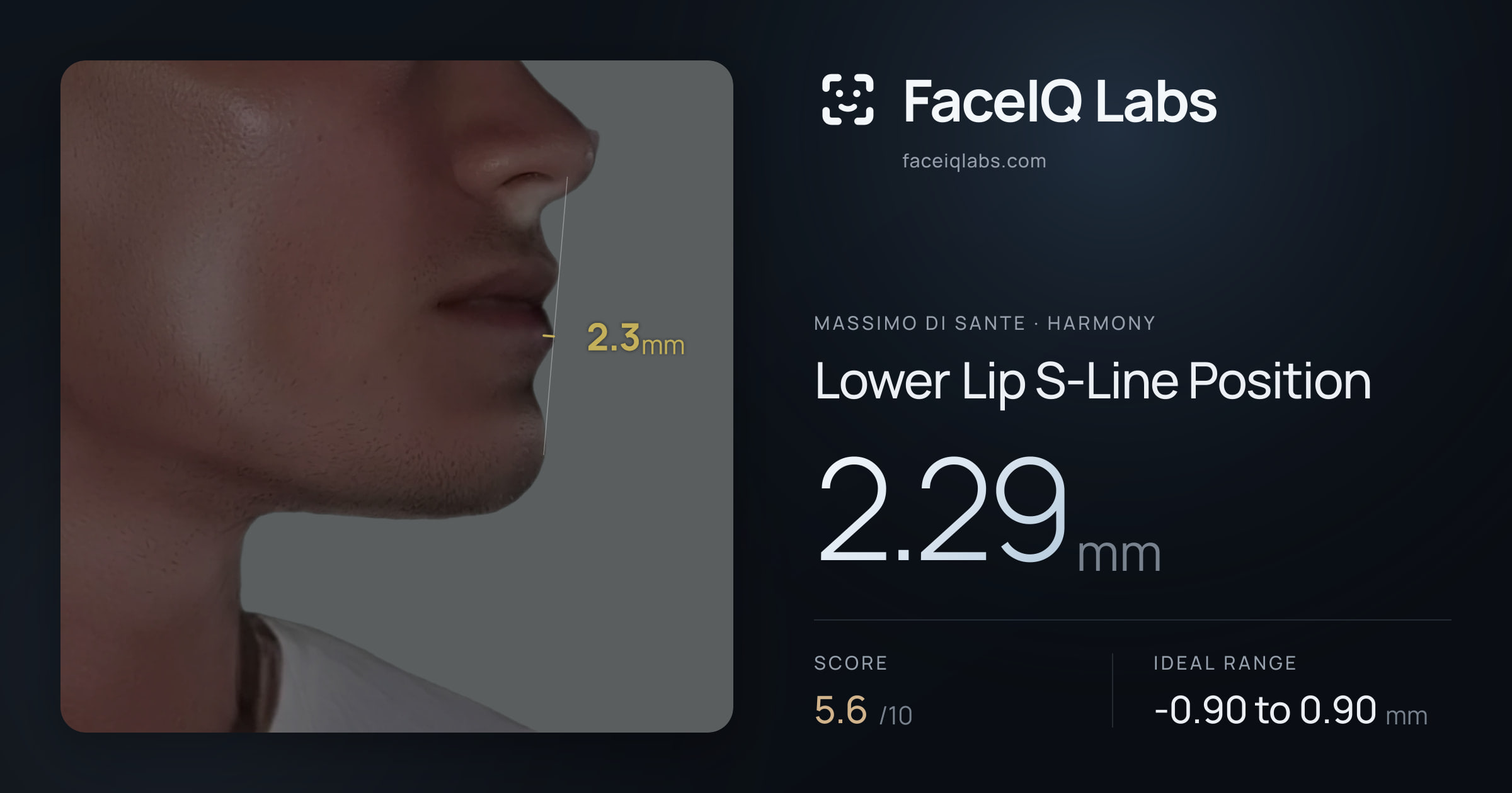 Massimo di Sante Lower Lip S-Line Position: 2.29mm, drawn on the photo