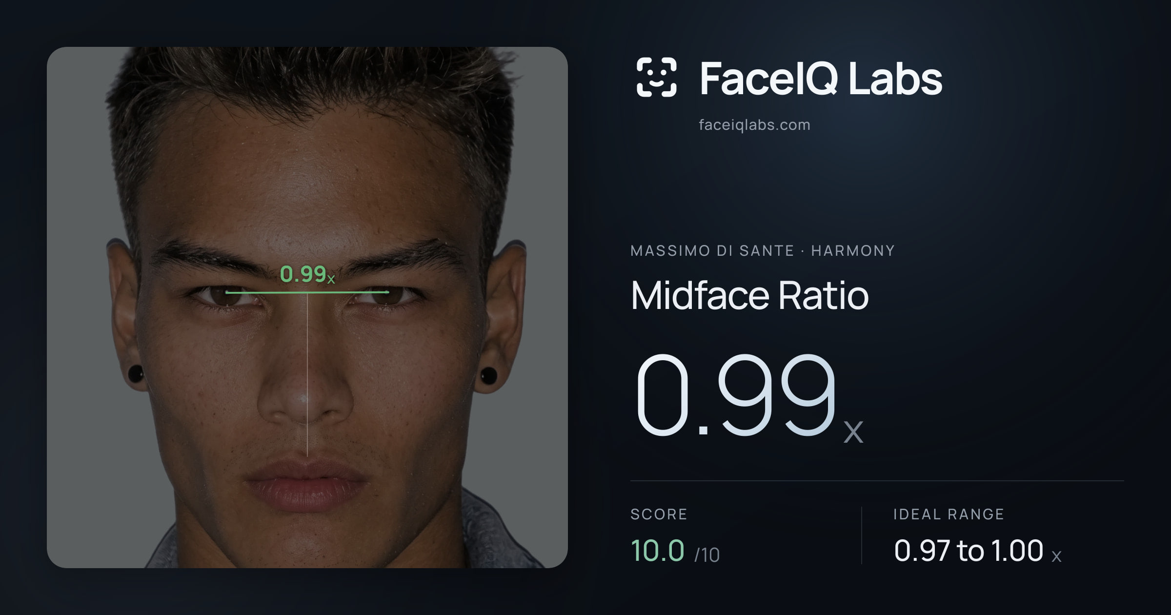 Massimo di Sante Midface Ratio: 0.99x, drawn on the photo