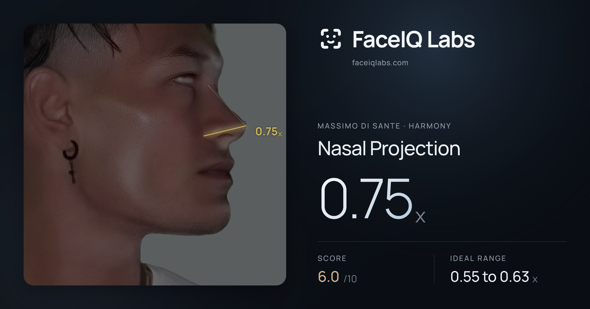 Massimo di Sante Nasal Projection: 0.75x, drawn on the photo