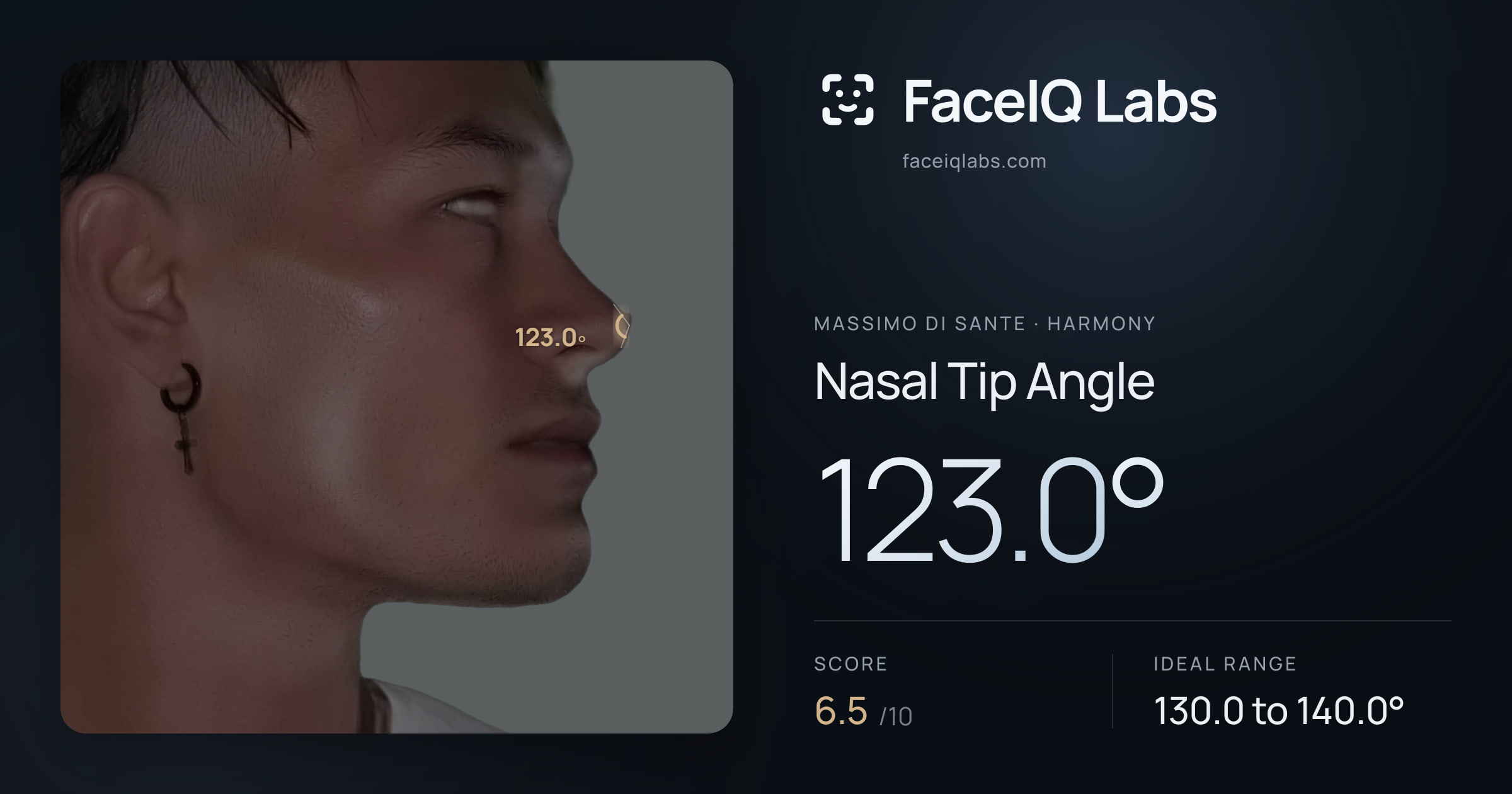 Massimo di Sante Nasal Tip Angle: 123.0°, drawn on the photo