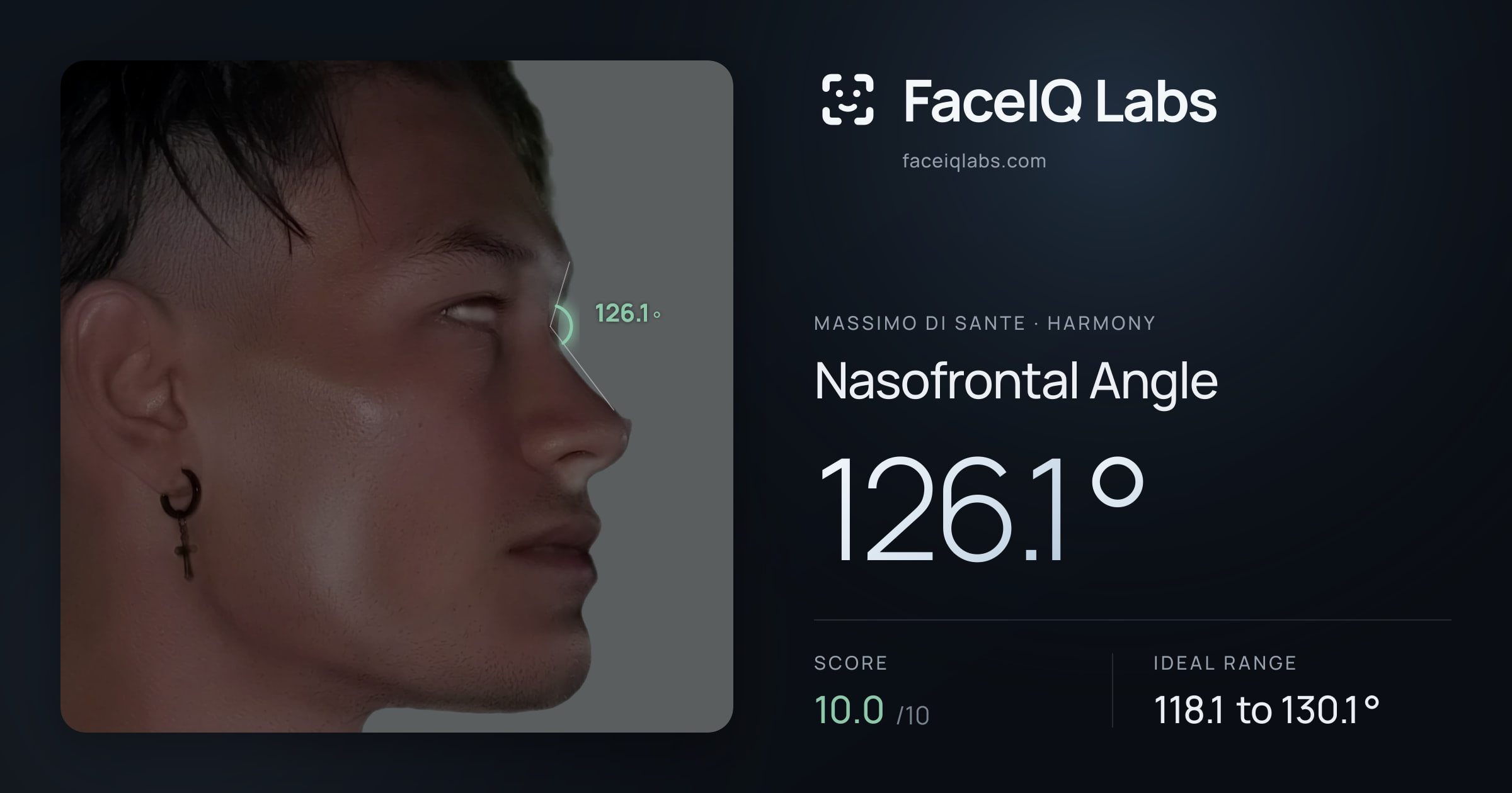 Massimo di Sante Nasofrontal Angle: 126.1°, drawn on the photo