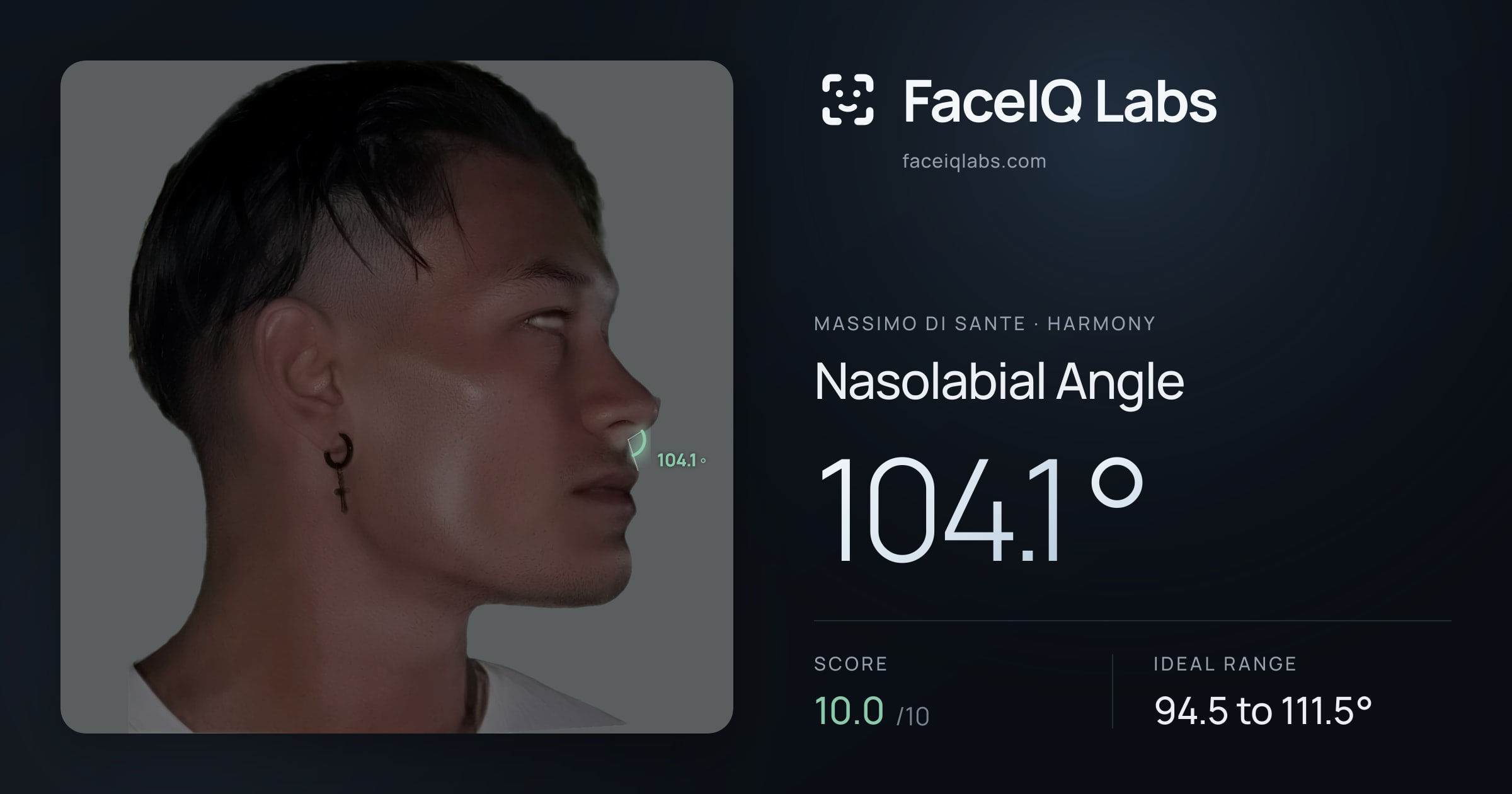 Massimo di Sante Nasolabial Angle: 104.1°, drawn on the photo