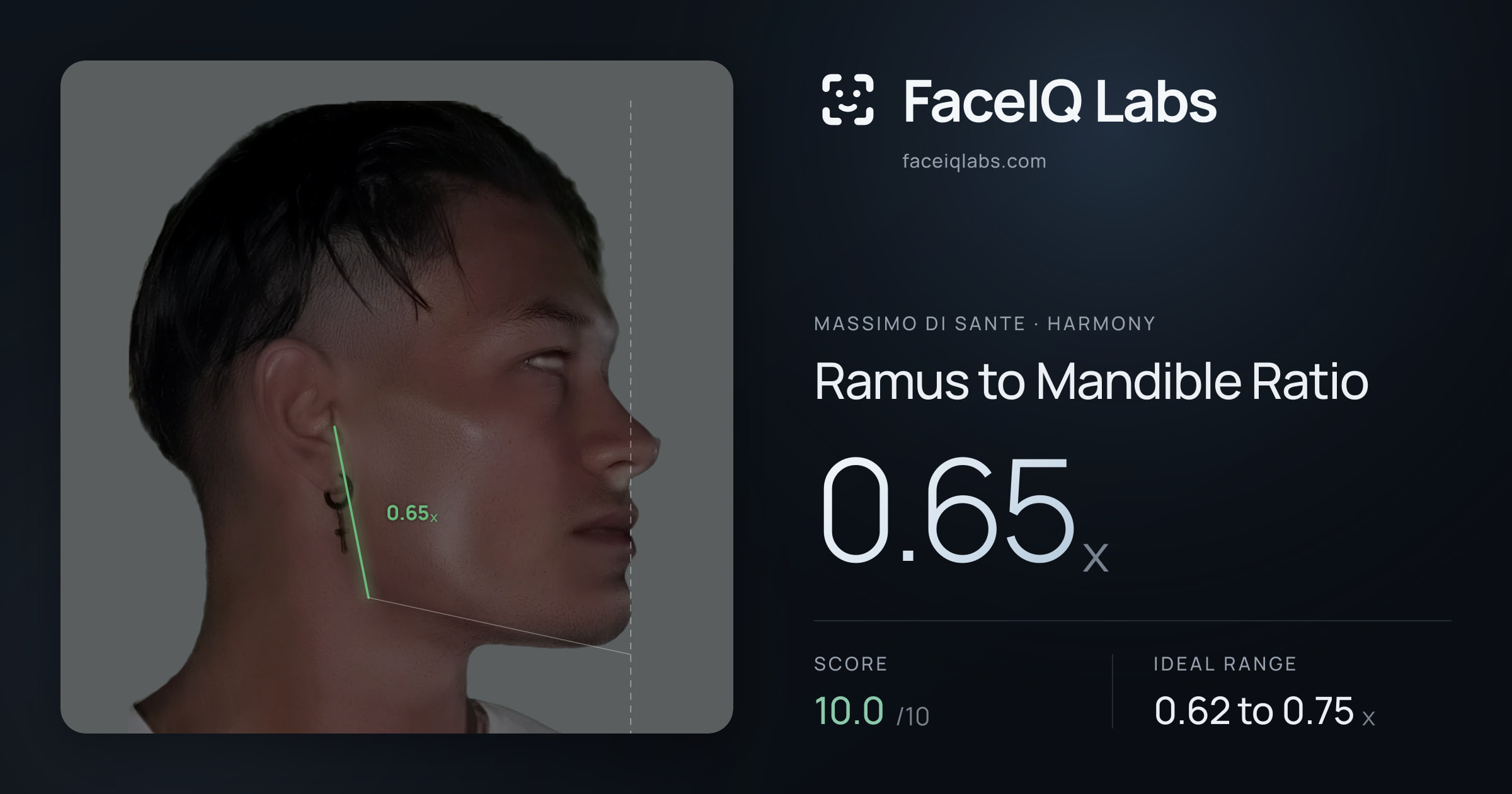 Massimo di Sante Ramus to Mandible Ratio: 0.65x, drawn on the photo