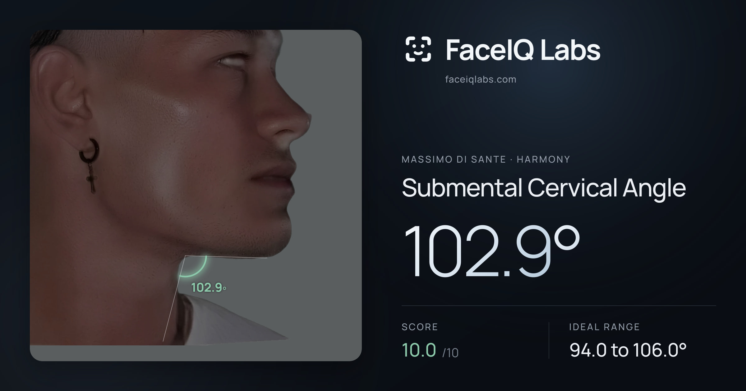Massimo di Sante Submental Cervical Angle: 102.9°, drawn on the photo